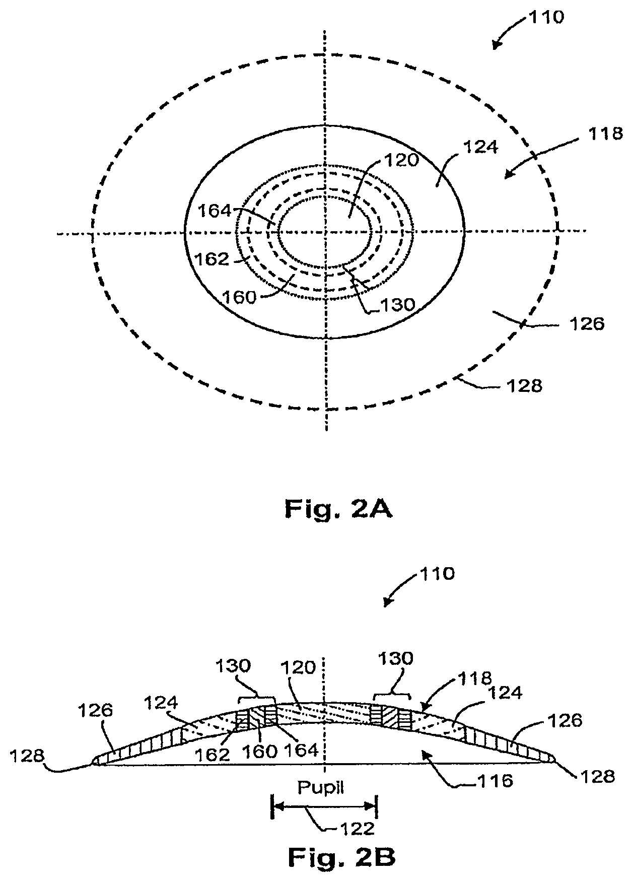 Patent US12306473 Figure 2 – Means for controlling the progression of myopia