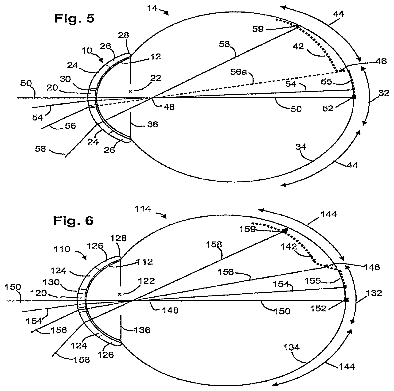 Patent US12306473 Figure 5 – Means for controlling the progression of myopia