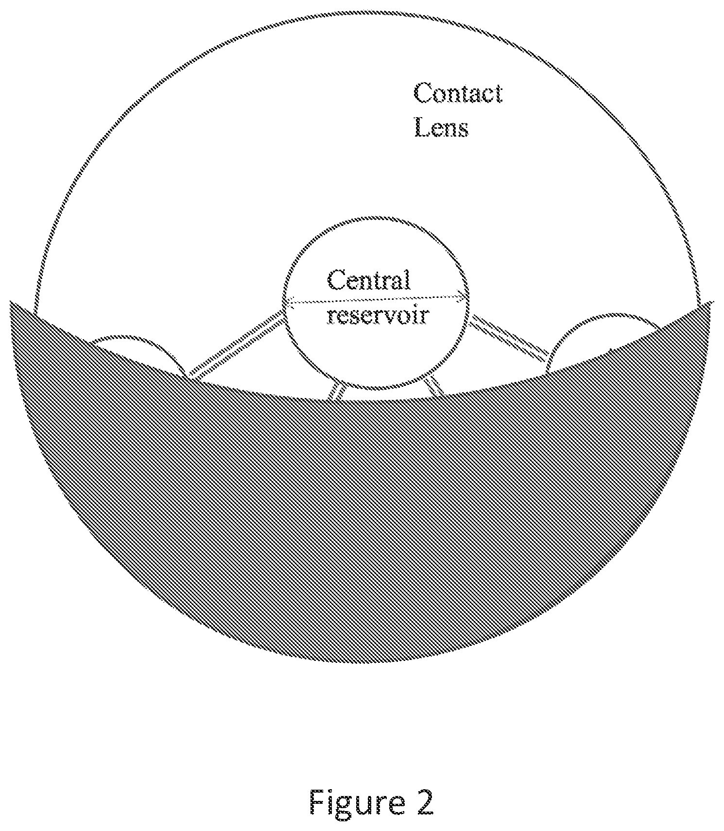 Patent US12306475 Figure 2 – Fluidic module for accommodating soft contact lens