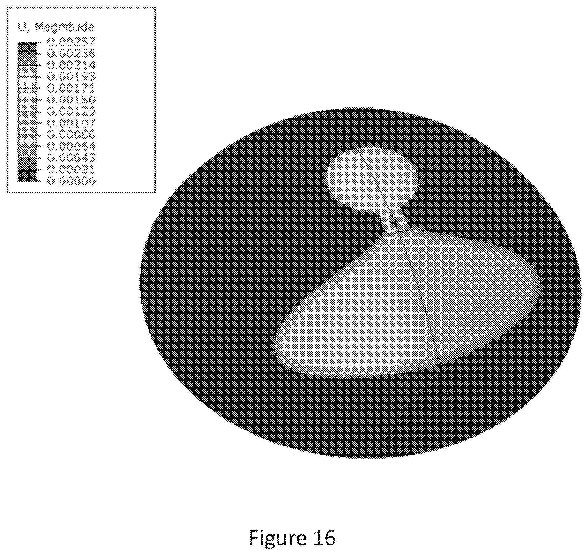 Patent US12306475 Figure 18 – Fluidic module for accommodating soft contact lens