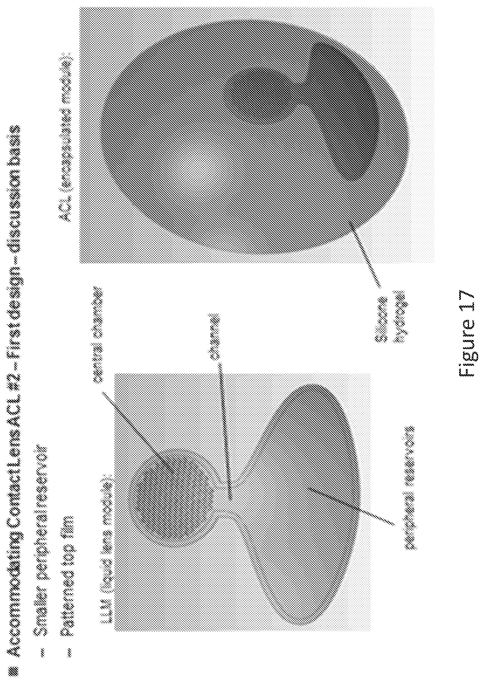 Patent US12306475 Figure 19 – Fluidic module for accommodating soft contact lens