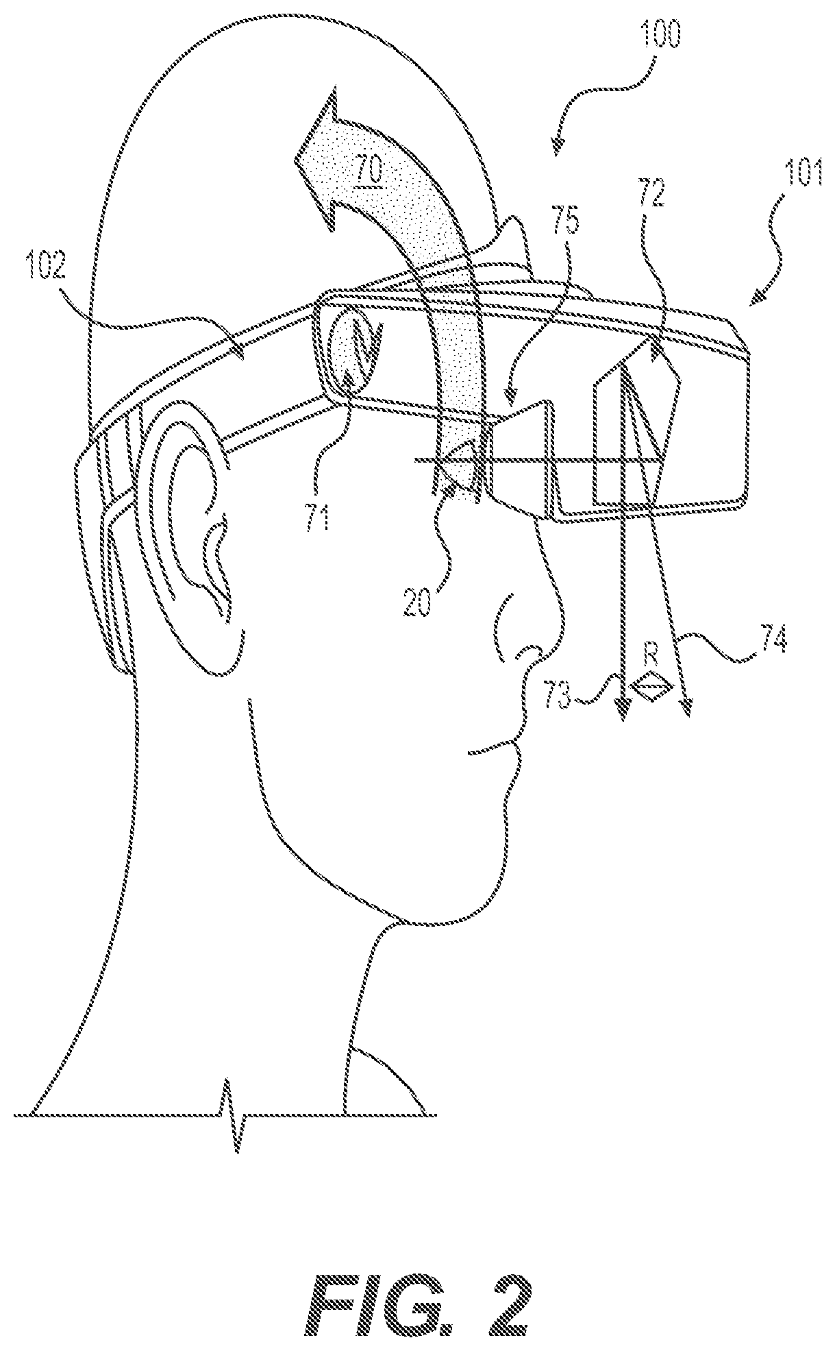 Patent US12306477 Figure 2 – Wearable vision redirecting devices