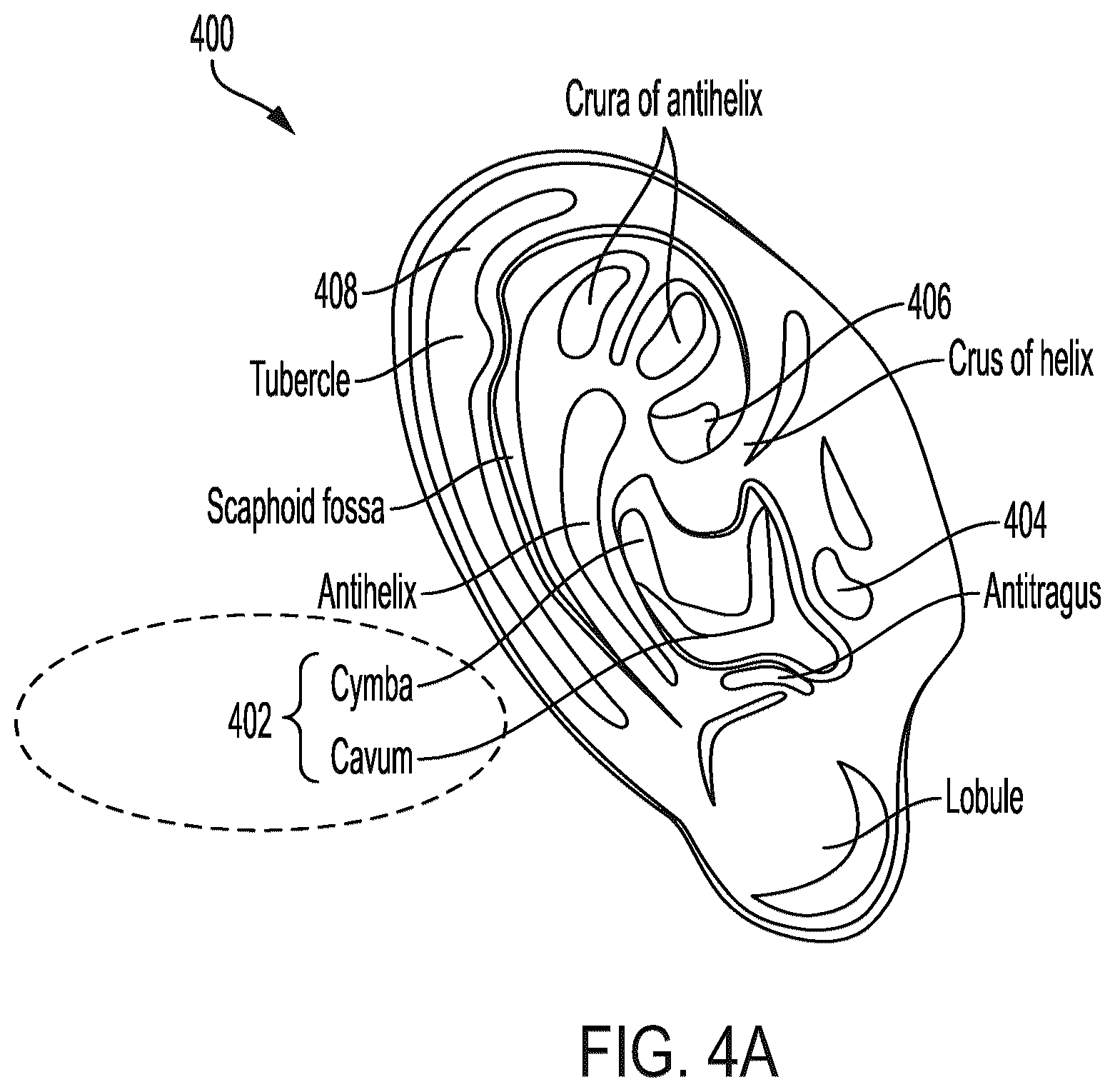 Patent US12307014 Figure 6 – Earbud sensory assembly