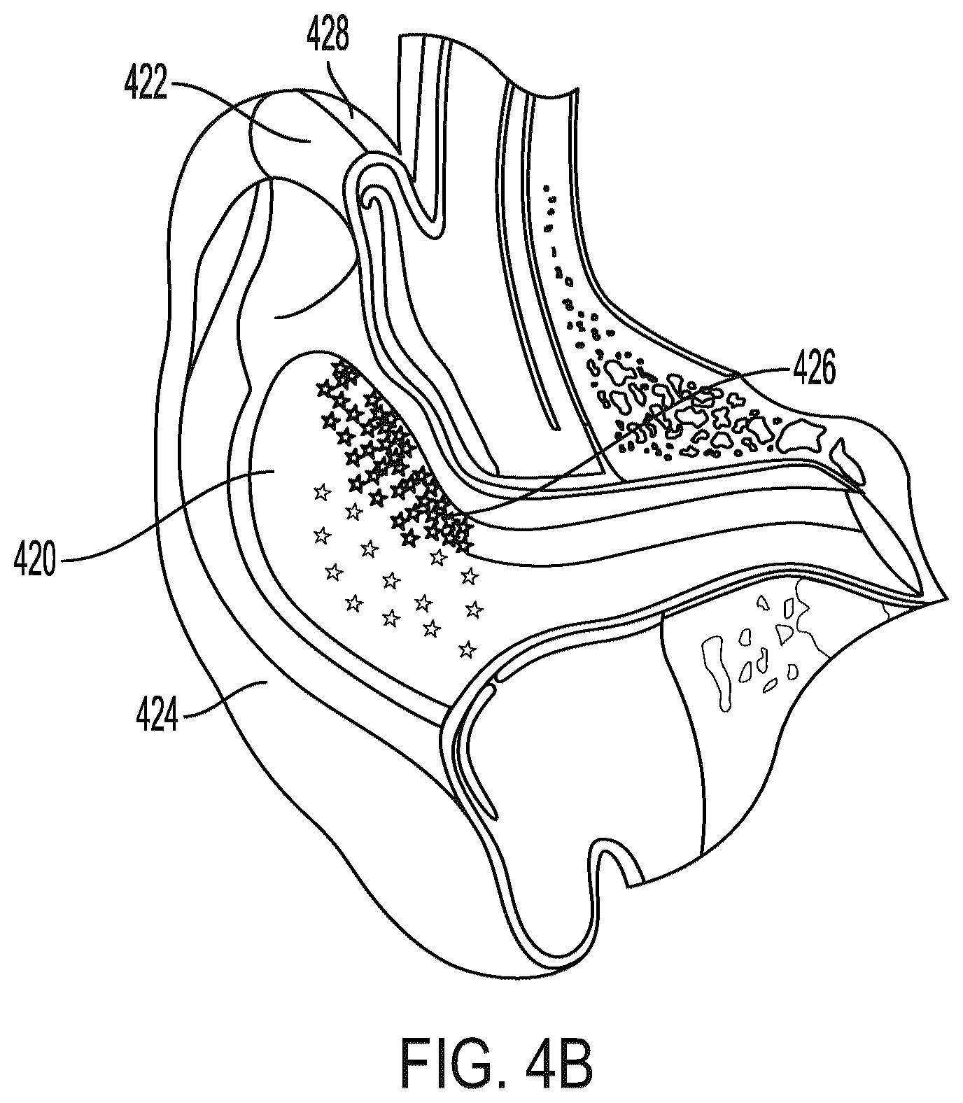 Patent US12307014 Figure 7 – Earbud sensory assembly