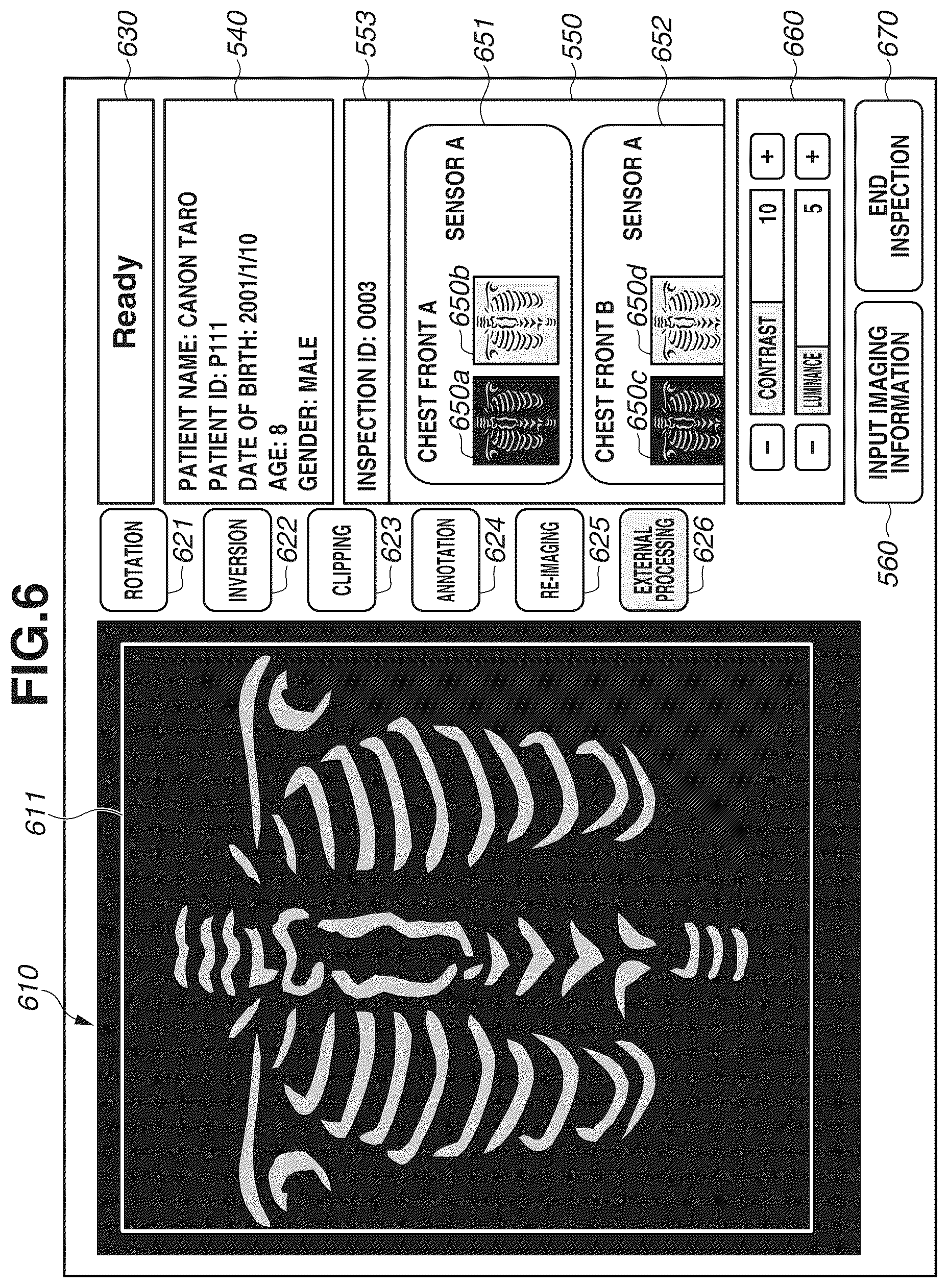 Patent US12307151 Figure 8 – Information processing apparatus, information processing method, radiation imaging system, and storage medium