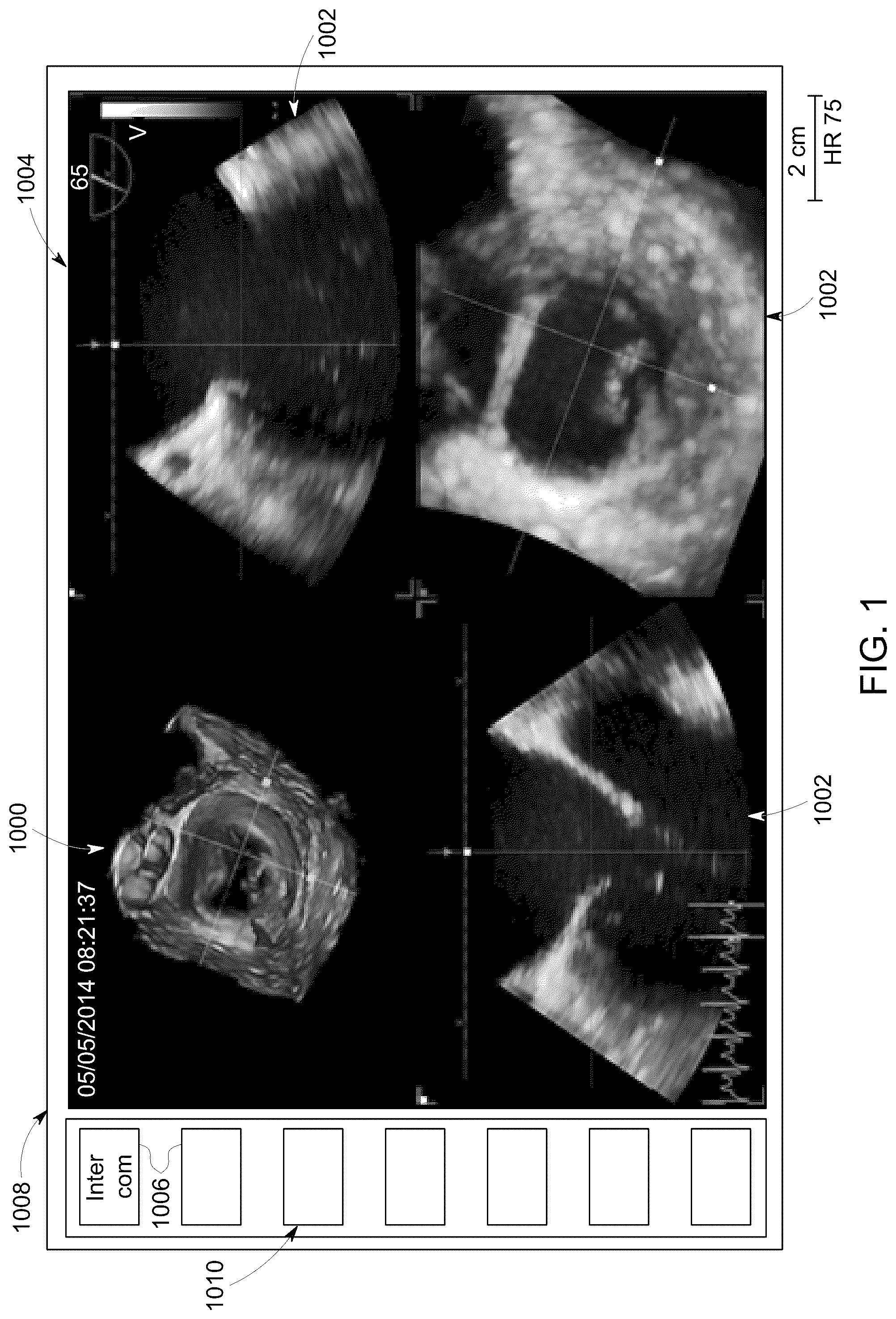 Patent US12307556 — Automatic model-based navigation system and method for ultrasound images — Figure 1