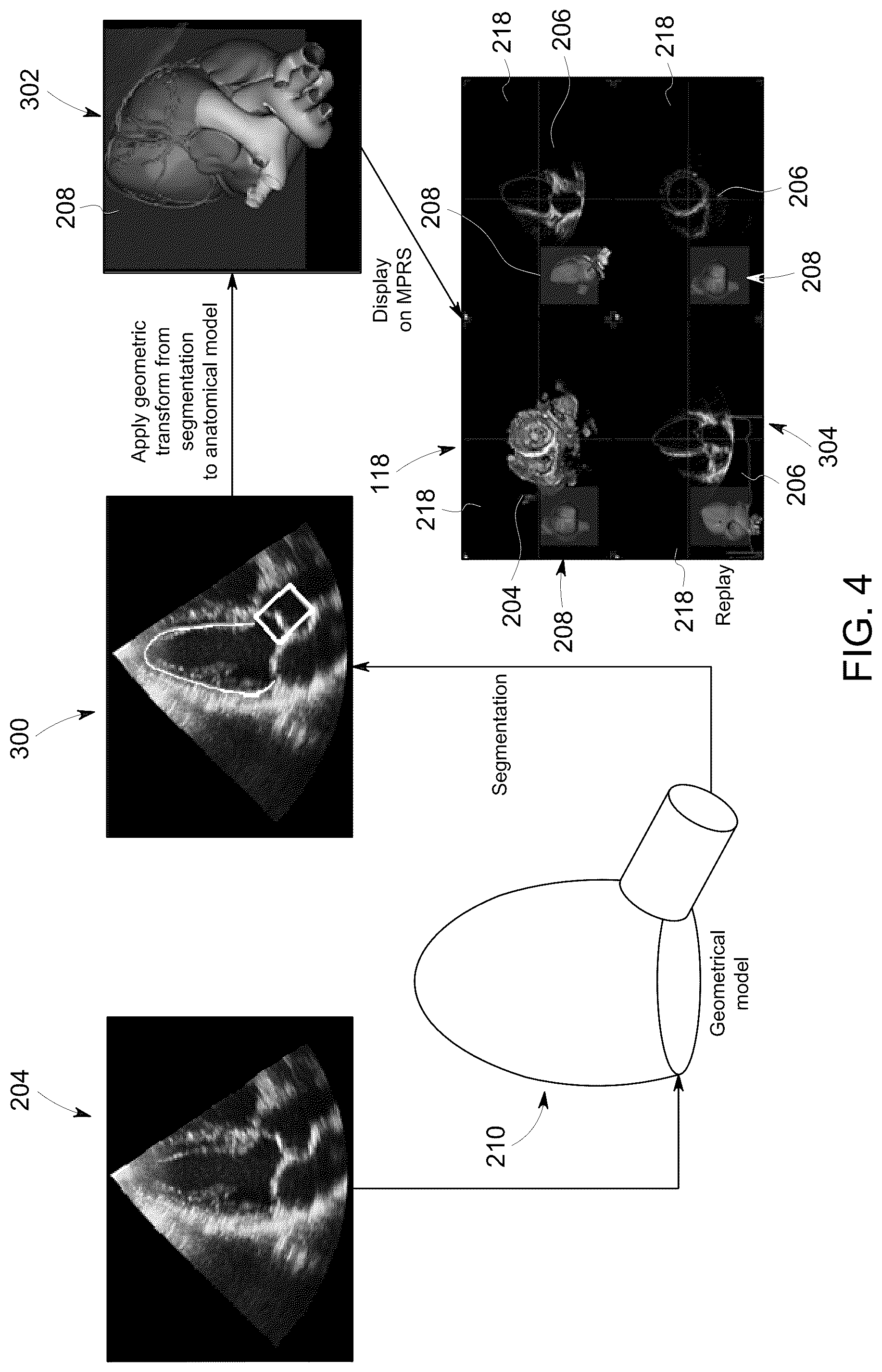 Patent US12307556 Figure 4 – Automatic model-based navigation system and method for ultrasound images