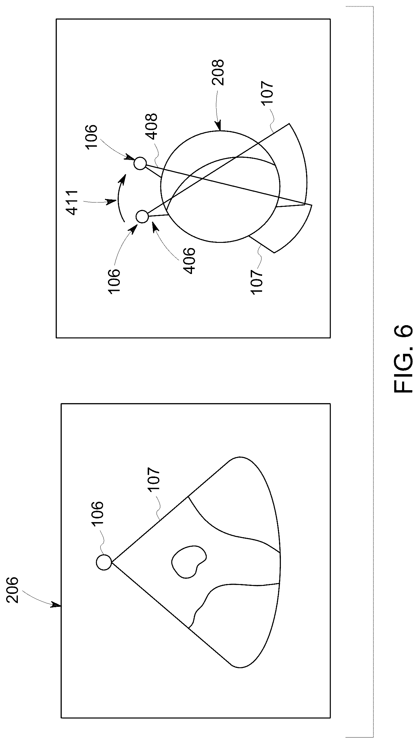 Patent US12307556 Figure 6 – Automatic model-based navigation system and method for ultrasound images