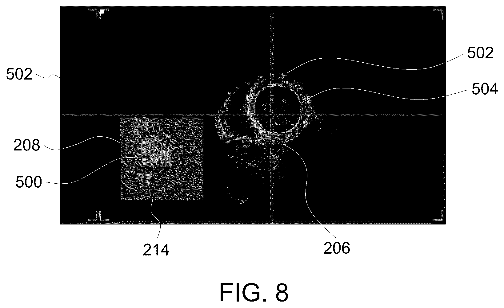 Patent US12307556 Figure 8 – Automatic model-based navigation system and method for ultrasound images