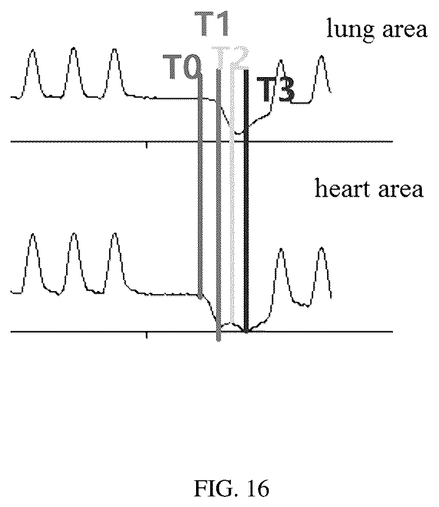 Patent US12307558 Figure 20 – Saline contrast electrical impedance lung perfusion and cardiac imaging image reconstruction and analysis method, system, device thereof