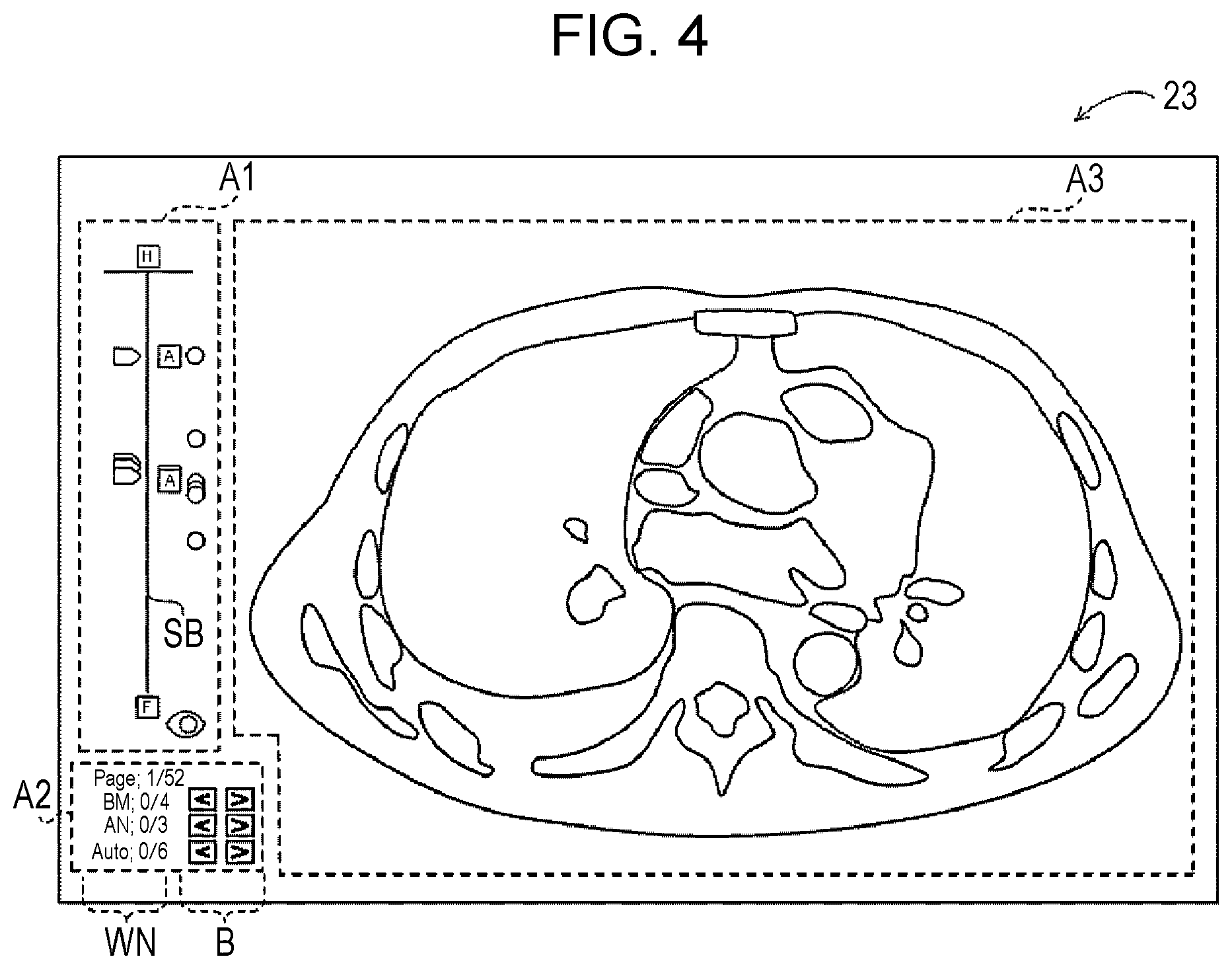 Patent US12307561 Figure 2 – Display control apparatus, display control method, and display control program