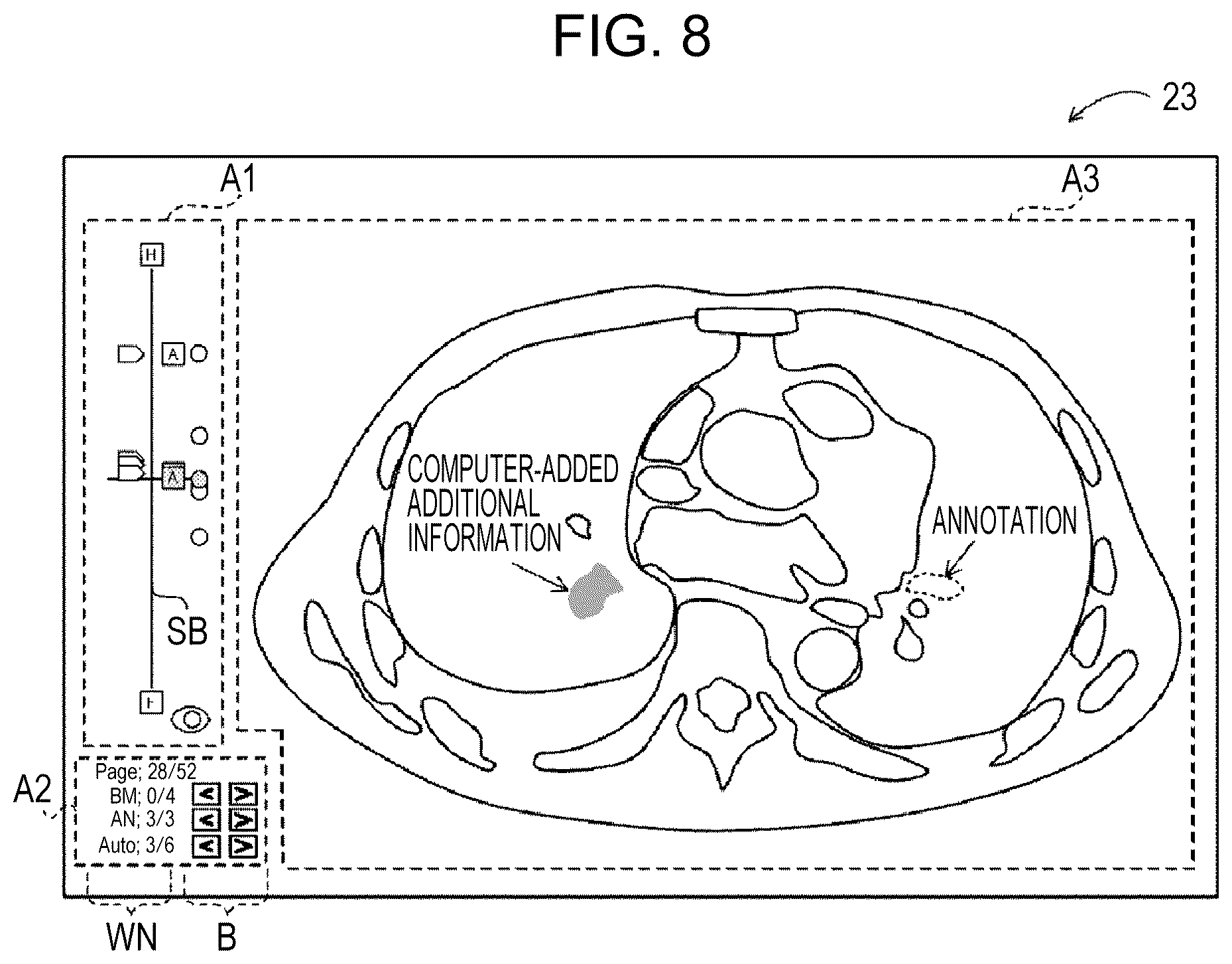 Patent US12307561 Figure 5 – Display control apparatus, display control method, and display control program