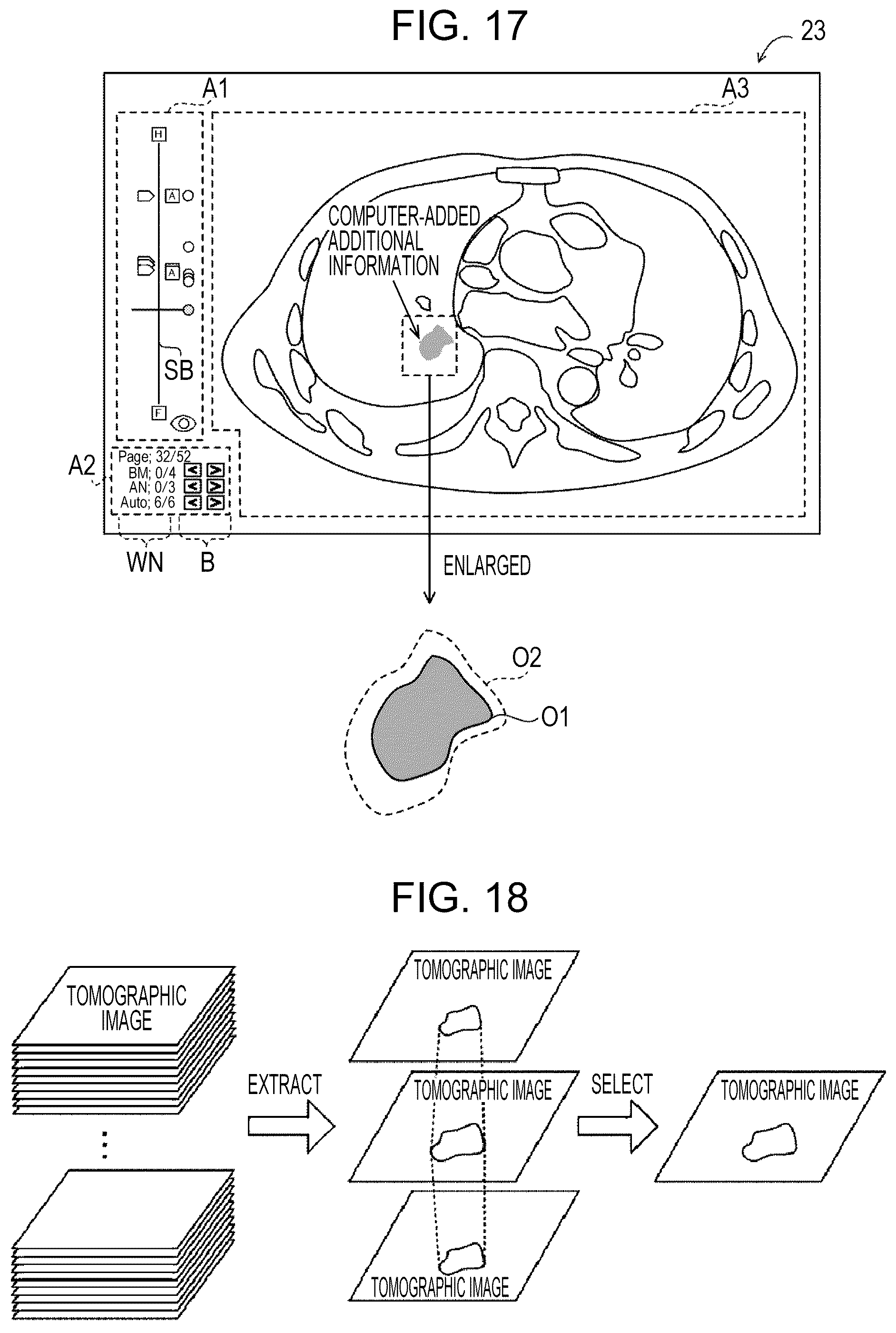 Patent US12307561 Figure 14 – Display control apparatus, display control method, and display control program