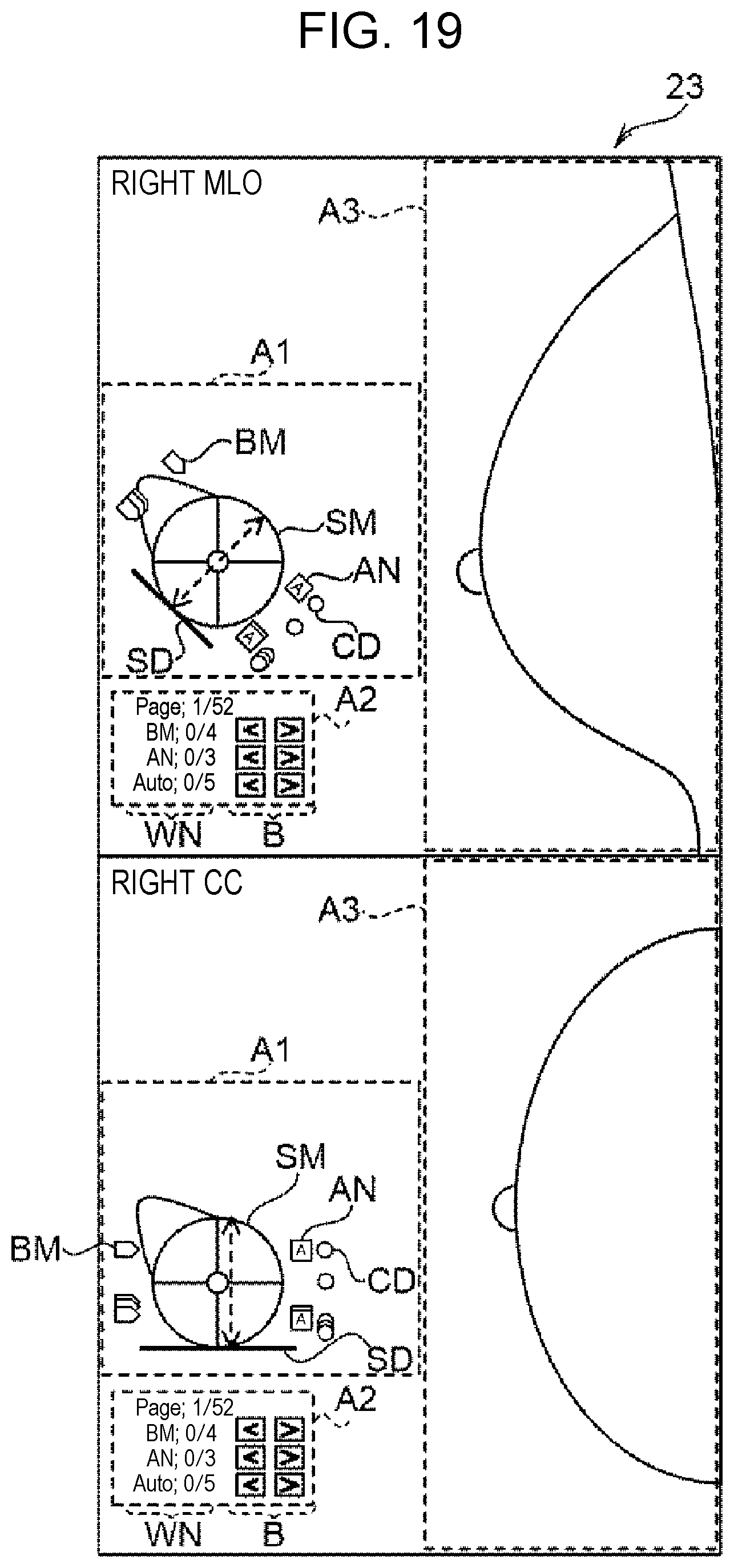 Patent US12307561 Figure 15 – Display control apparatus, display control method, and display control program