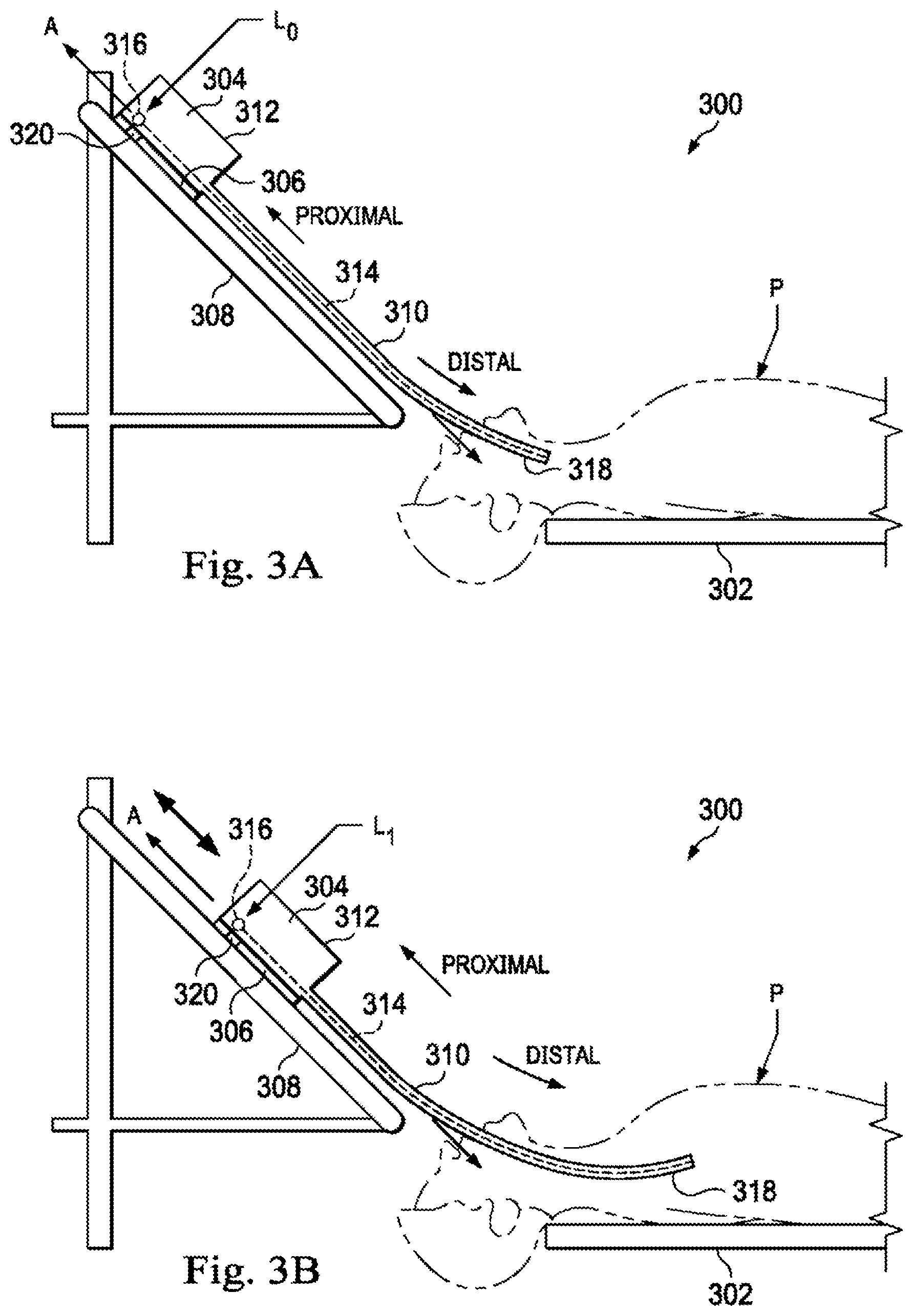 Patent US12307581 Figure 3 – Elongate device references for image-guided procedures