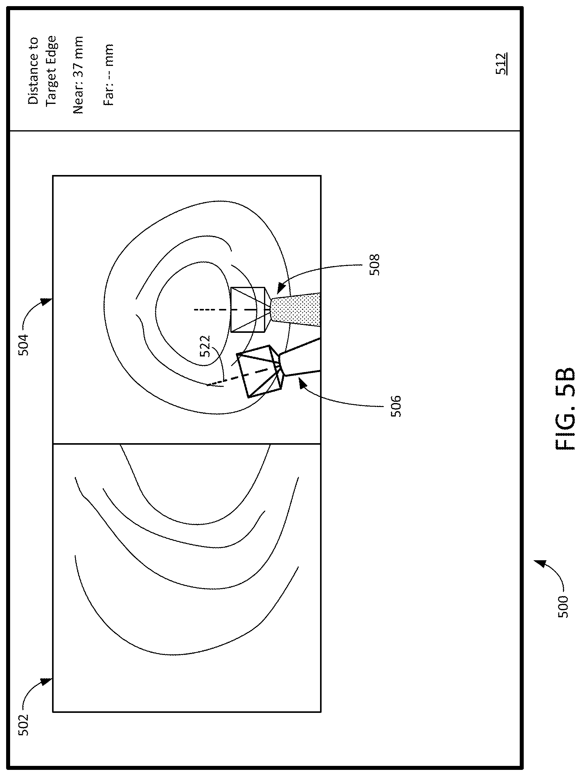 Patent US12307581 Figure 6 – Elongate device references for image-guided procedures