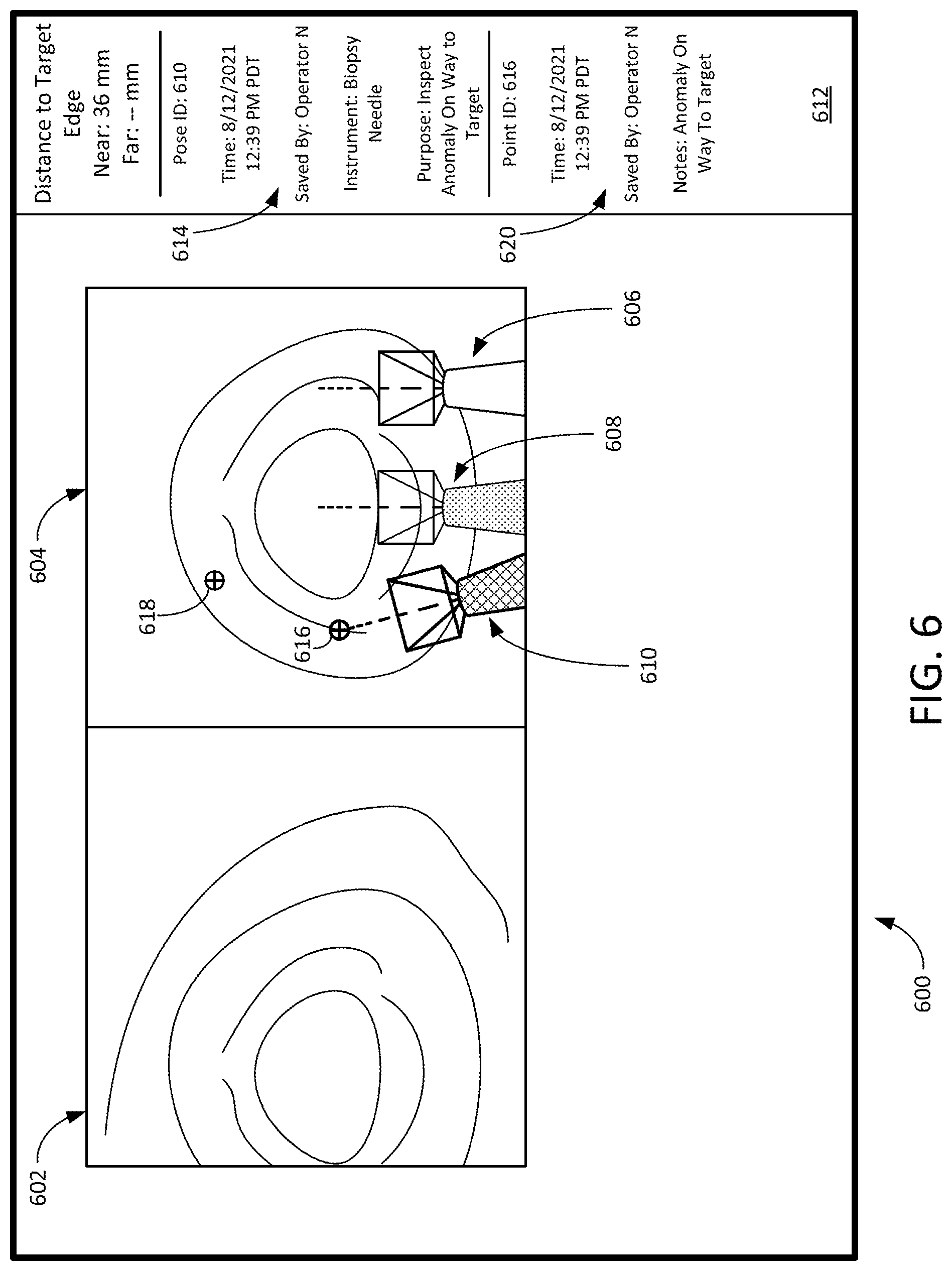 Patent US12307581 Figure 9 – Elongate device references for image-guided procedures