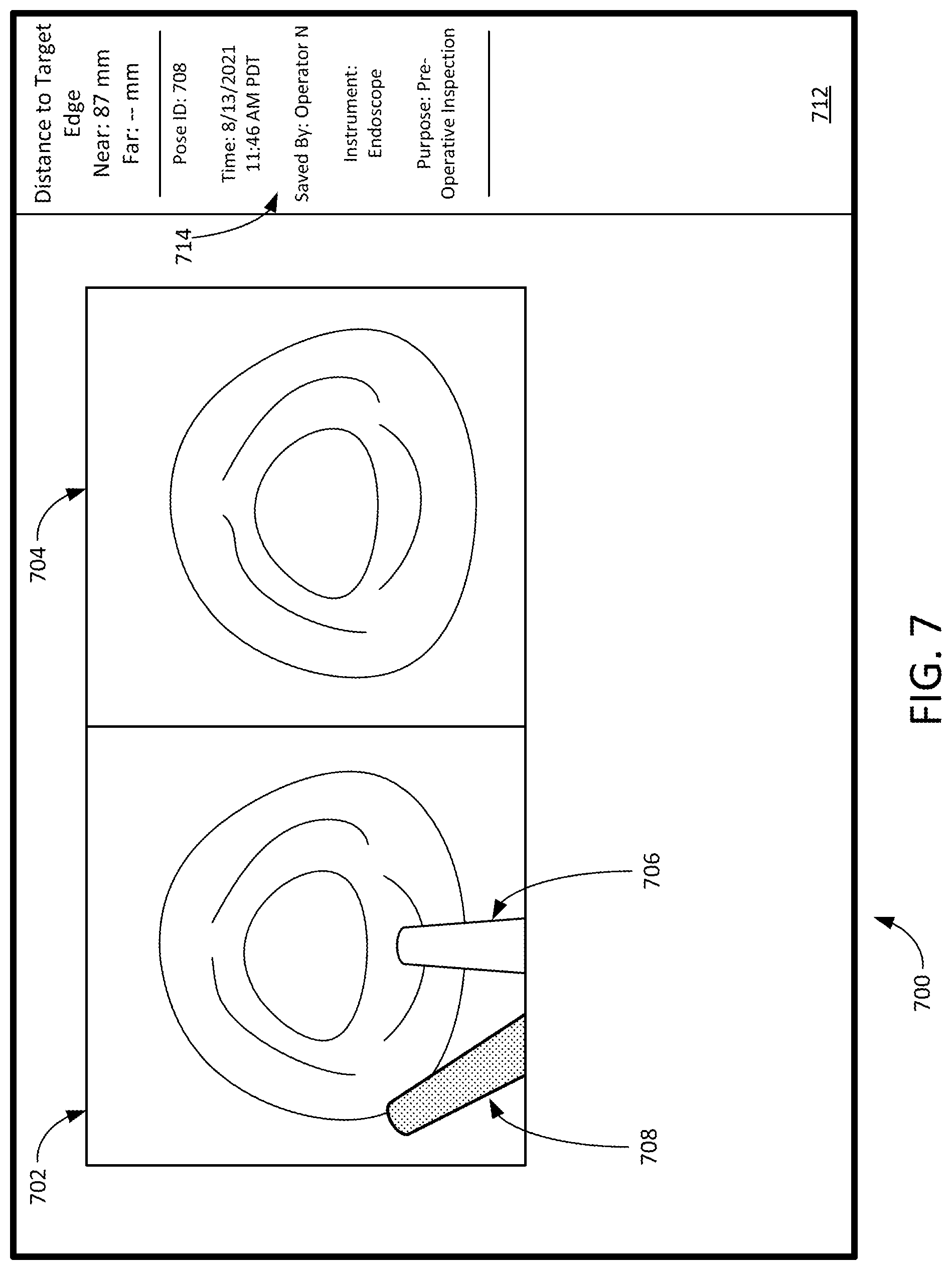 Patent US12307581 Figure 10 – Elongate device references for image-guided procedures