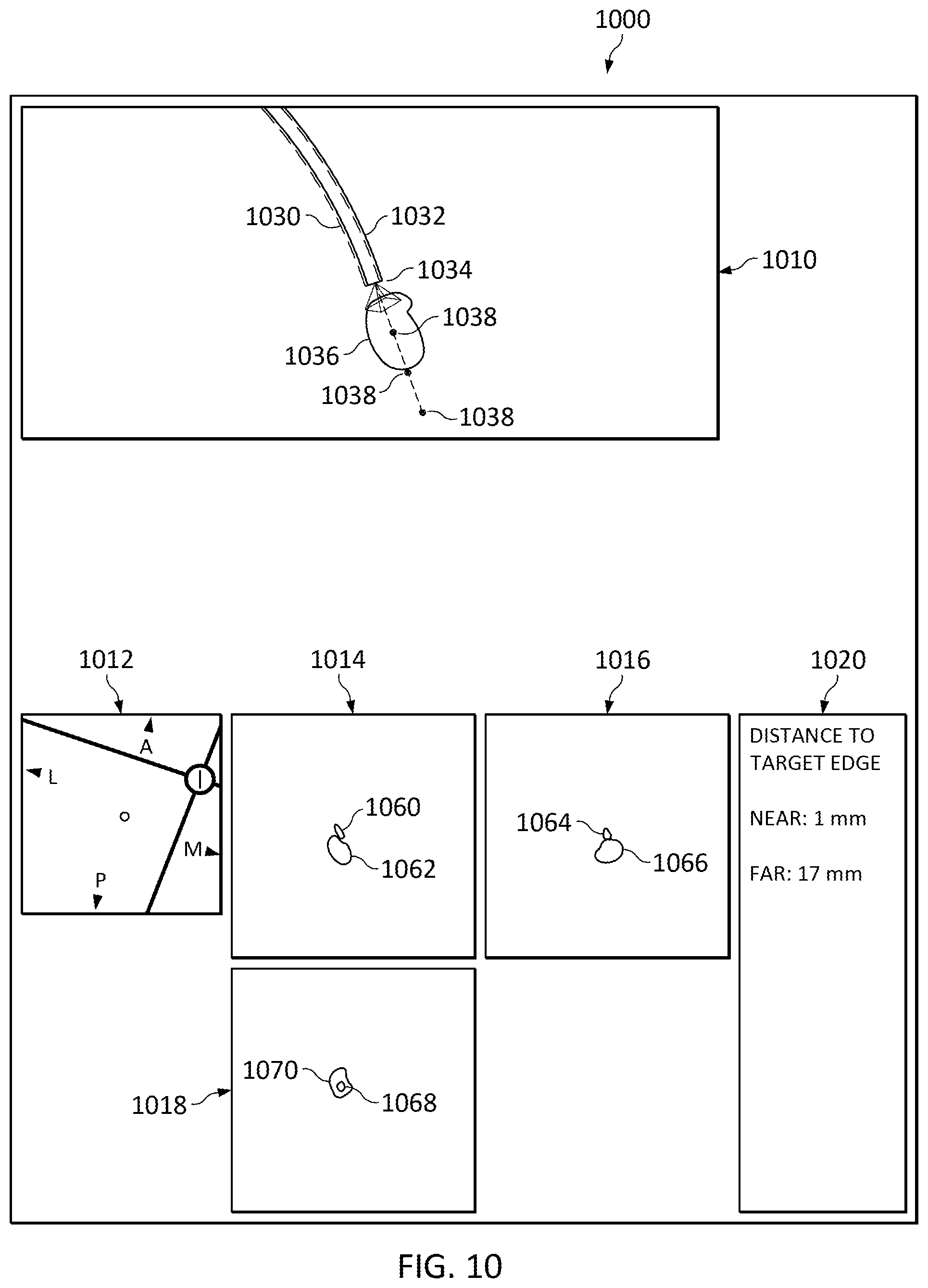 Patent US12307581 Figure 13 – Elongate device references for image-guided procedures