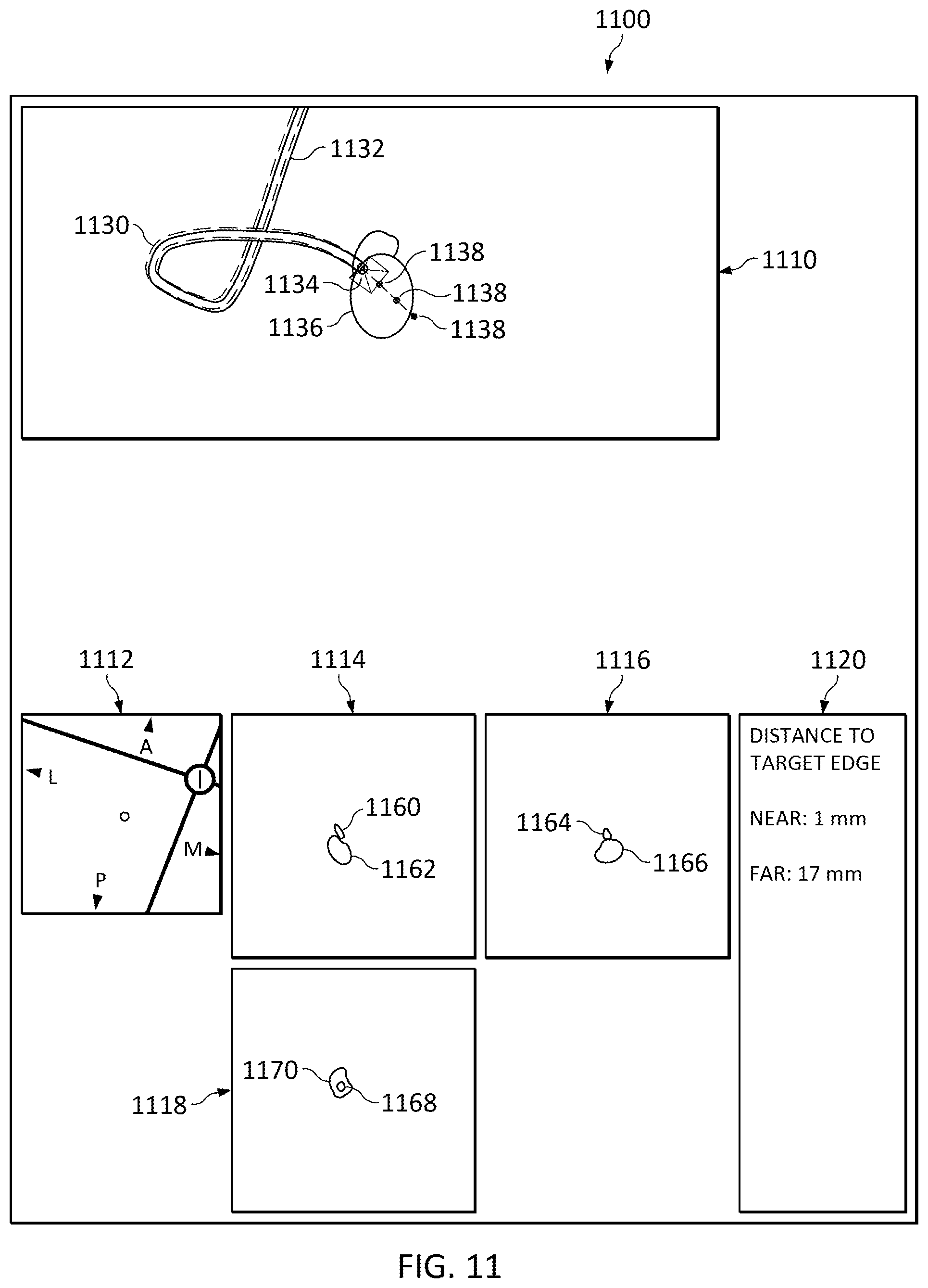 Patent US12307581 Figure 14 – Elongate device references for image-guided procedures