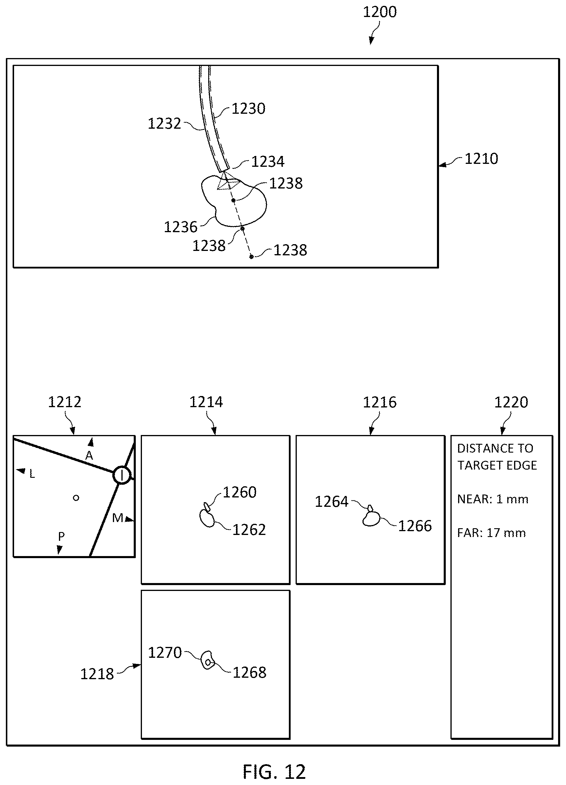 Patent US12307581 Figure 15 – Elongate device references for image-guided procedures