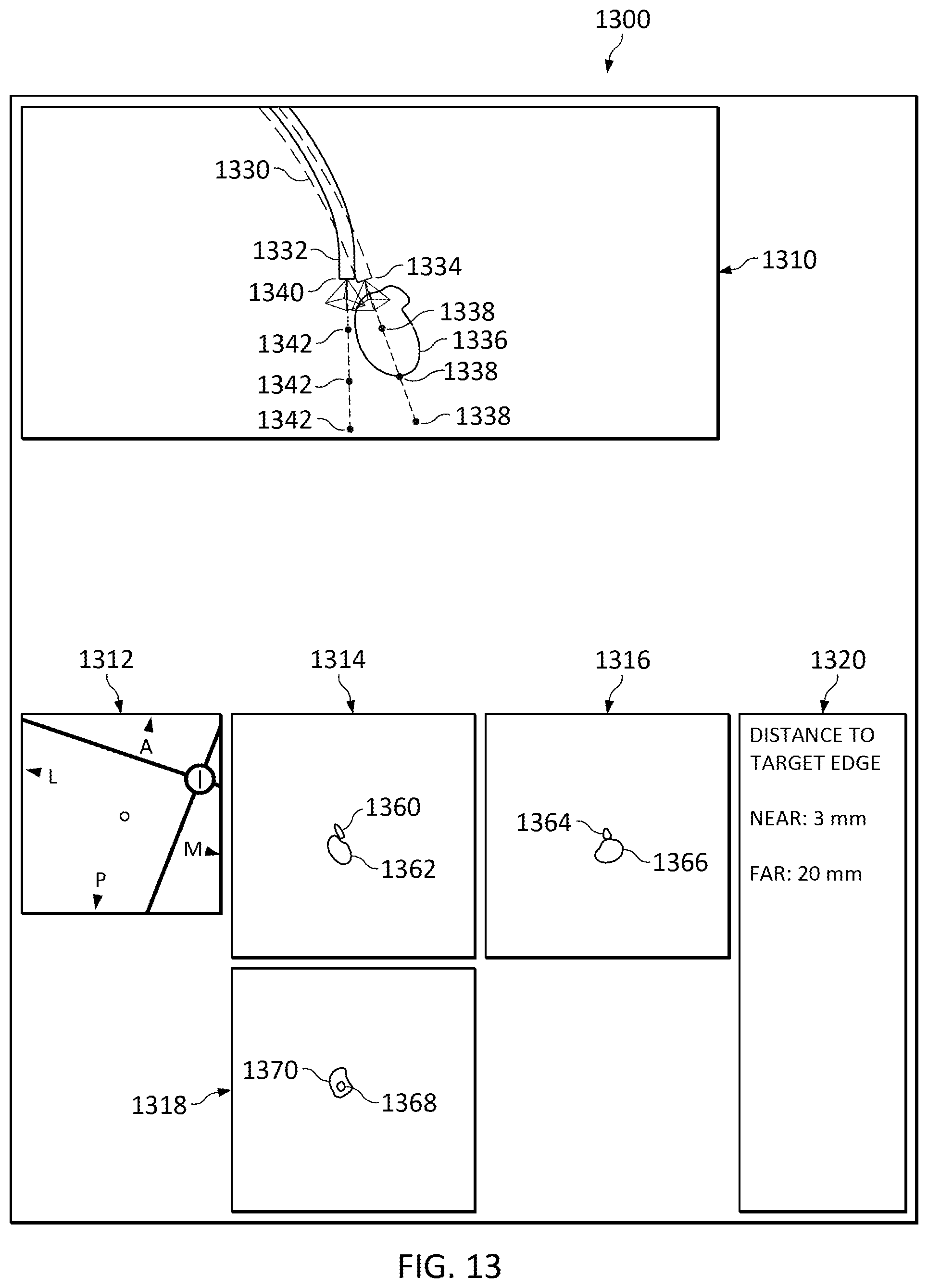 Patent US12307581 Figure 16 – Elongate device references for image-guided procedures