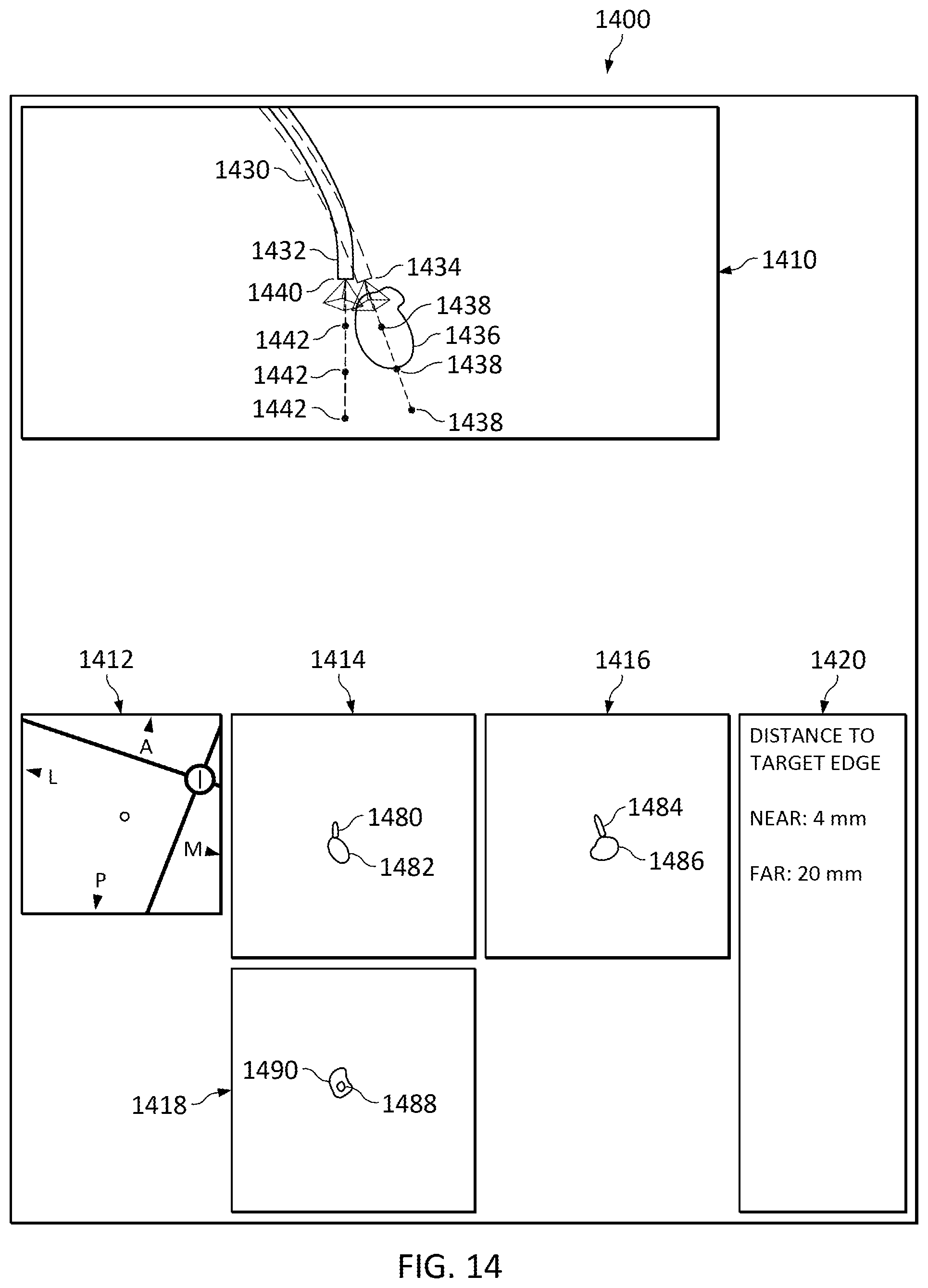 Patent US12307581 Figure 17 – Elongate device references for image-guided procedures
