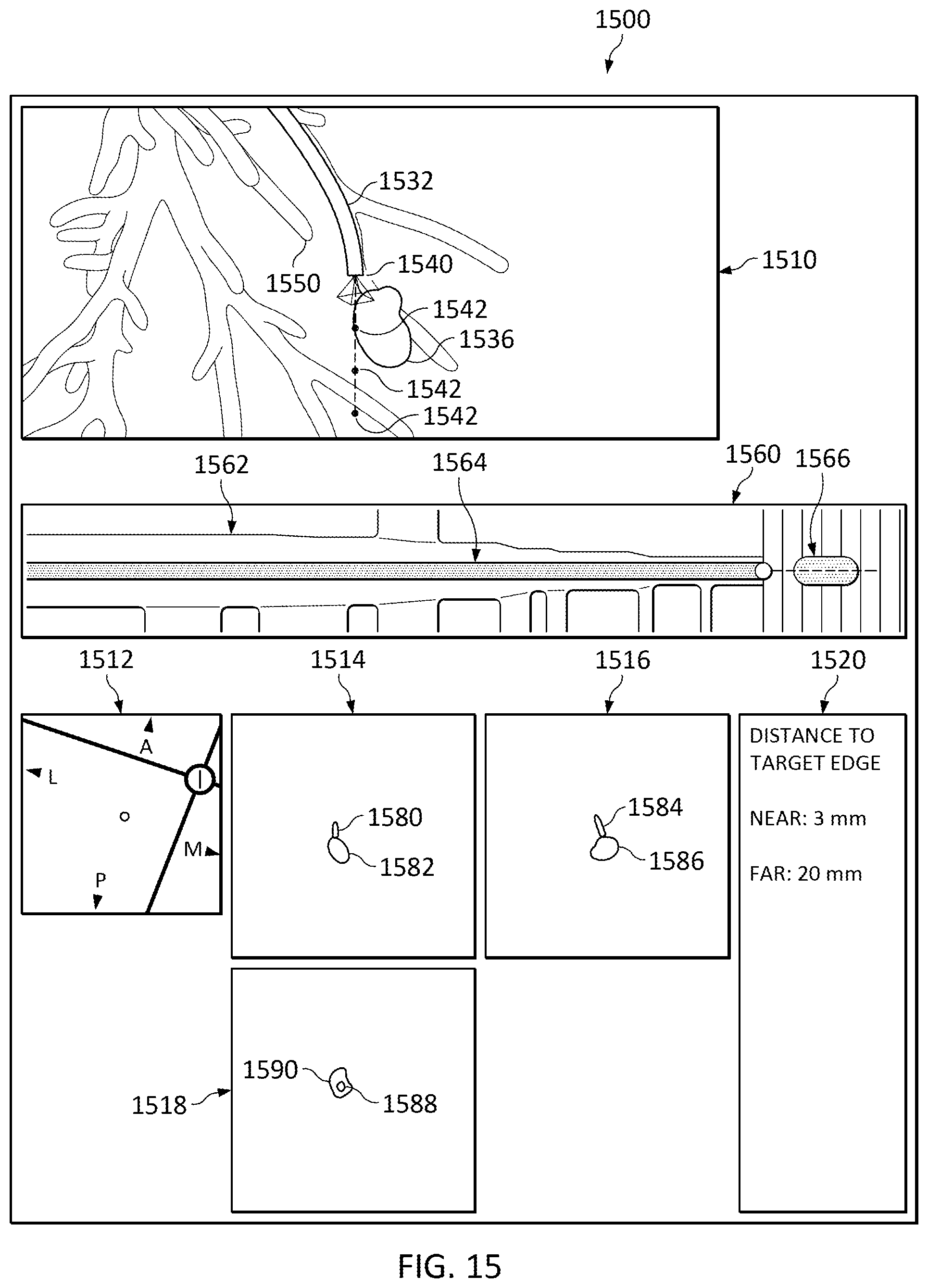 Patent US12307581 Figure 18 – Elongate device references for image-guided procedures