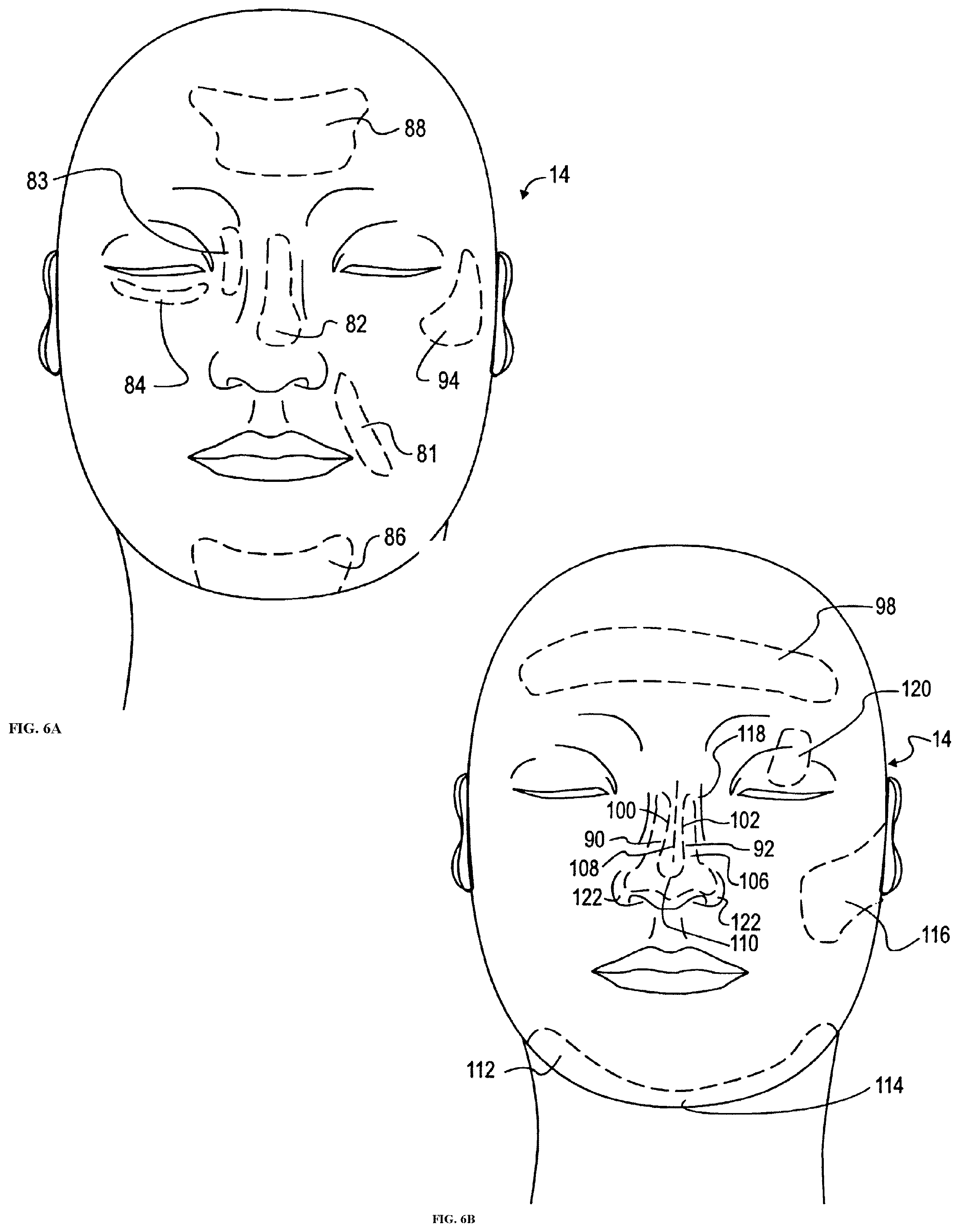 Patent US12307587 Figure 11 – AR/VR/XR system