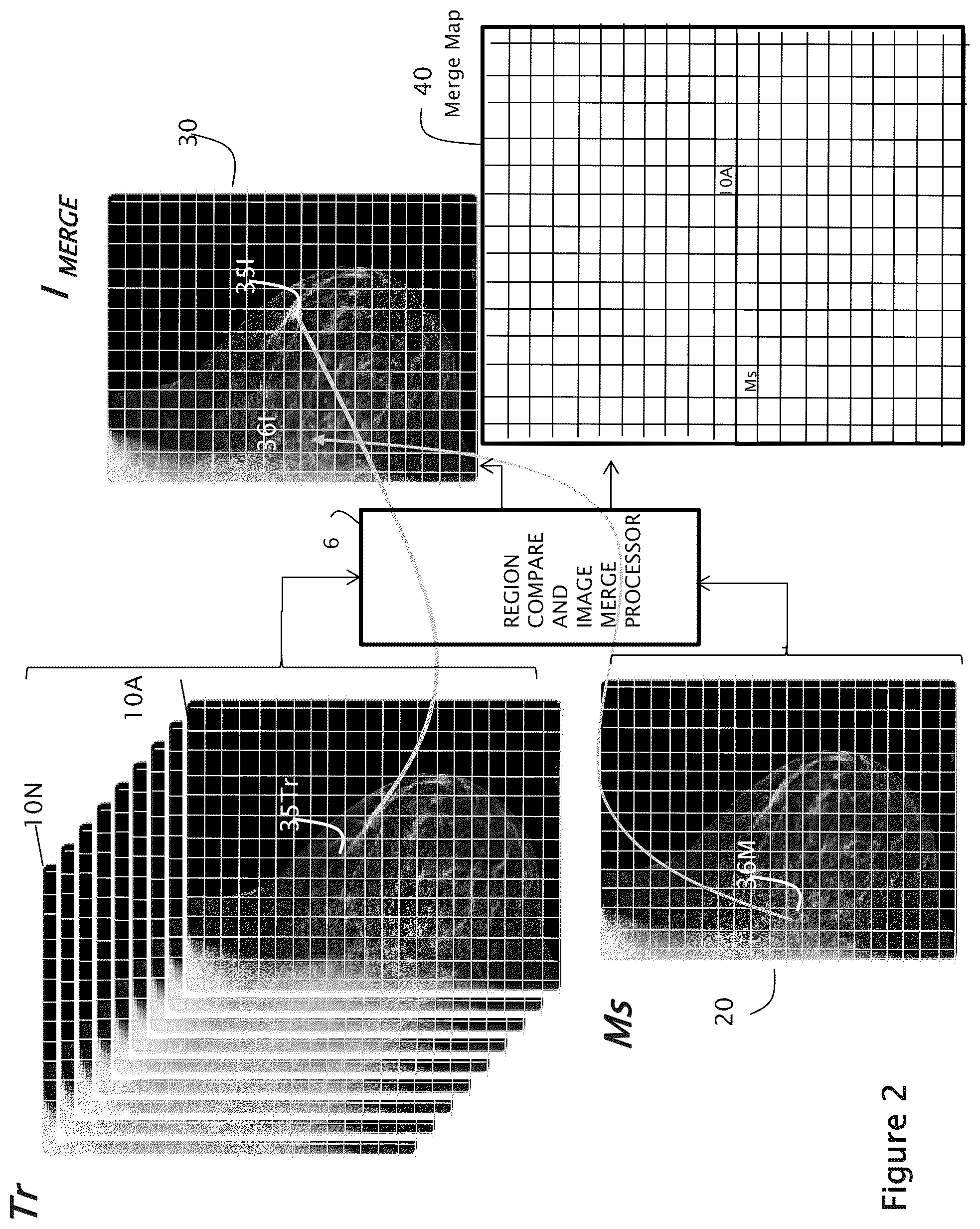 Patent US12307604 Figure 2 – System and method for navigating a tomosynthesis stack using synthesized image data