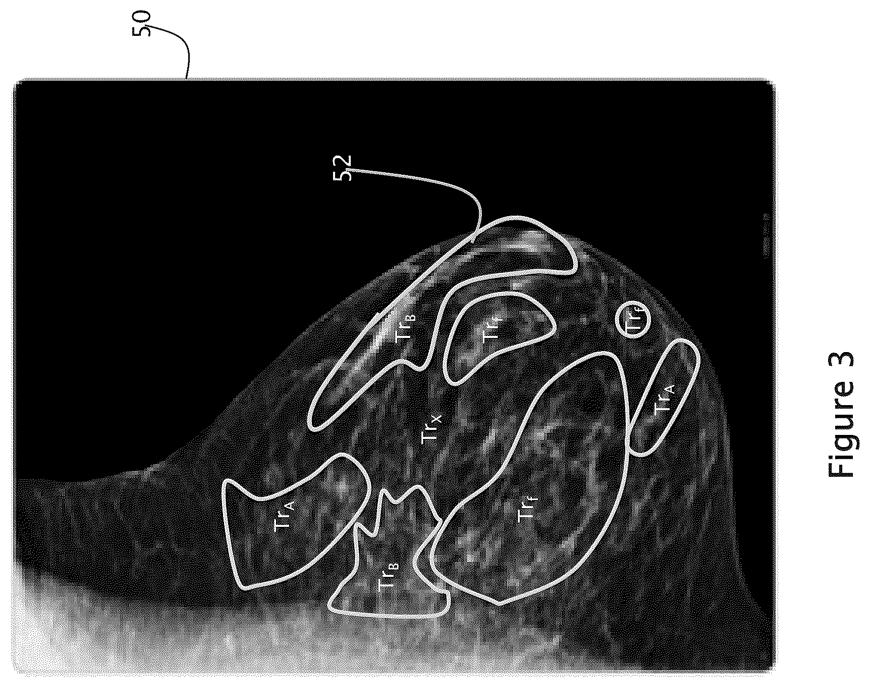 Patent US12307604 Figure 3 – System and method for navigating a tomosynthesis stack using synthesized image data