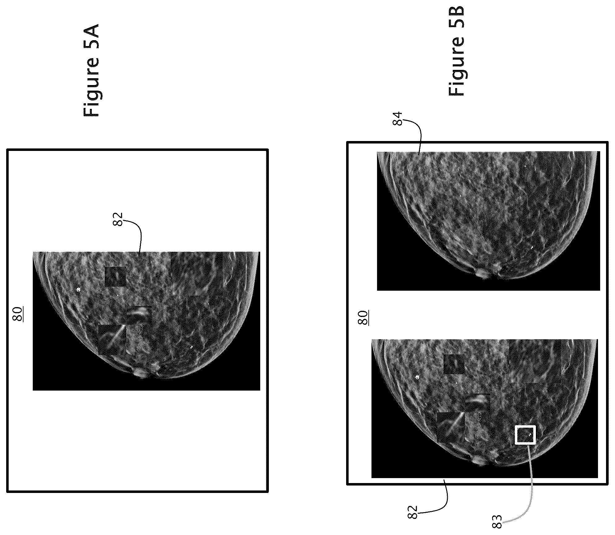 Patent US12307604 Figure 5 – System and method for navigating a tomosynthesis stack using synthesized image data