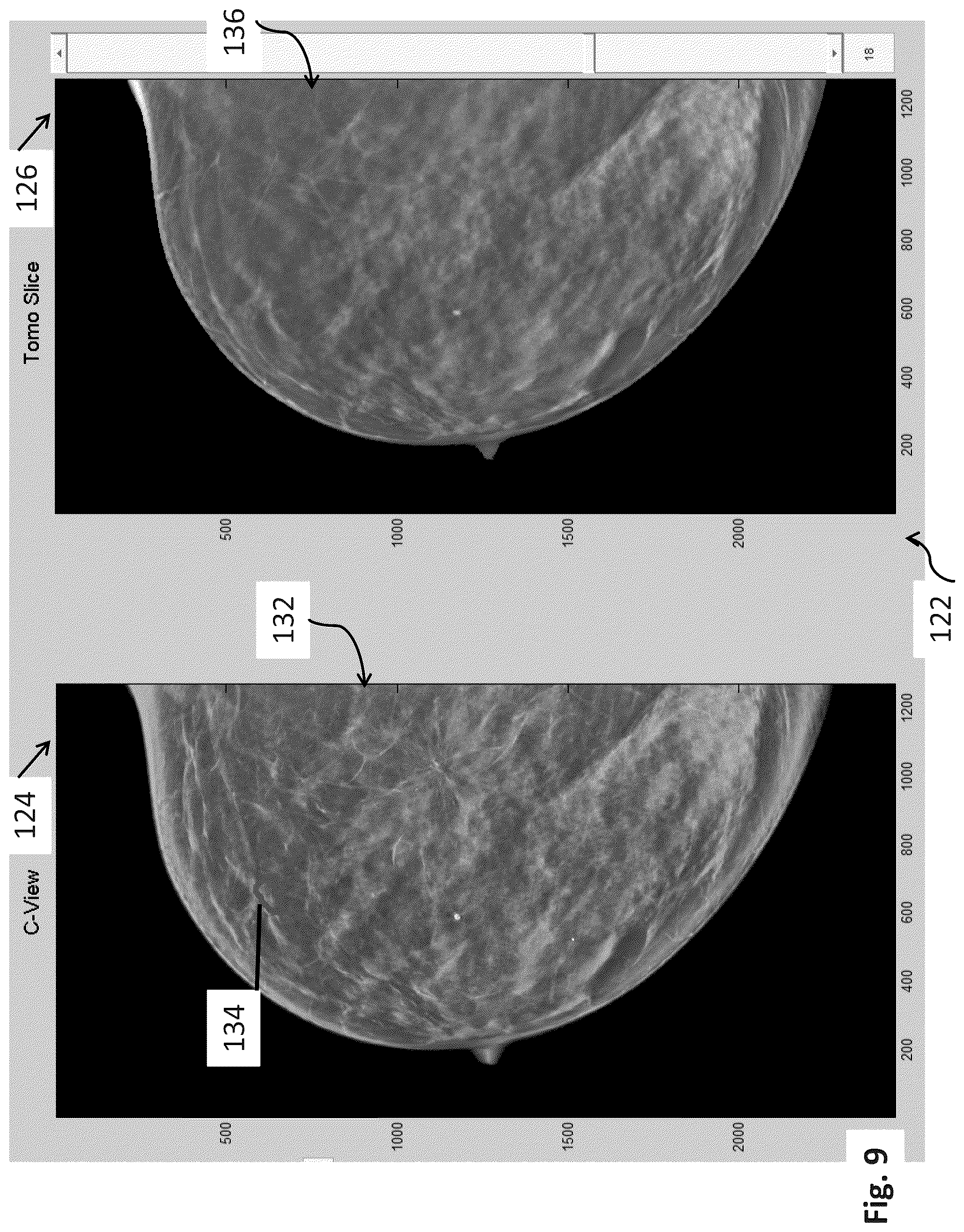 Patent US12307604 Figure 9 – System and method for navigating a tomosynthesis stack using synthesized image data