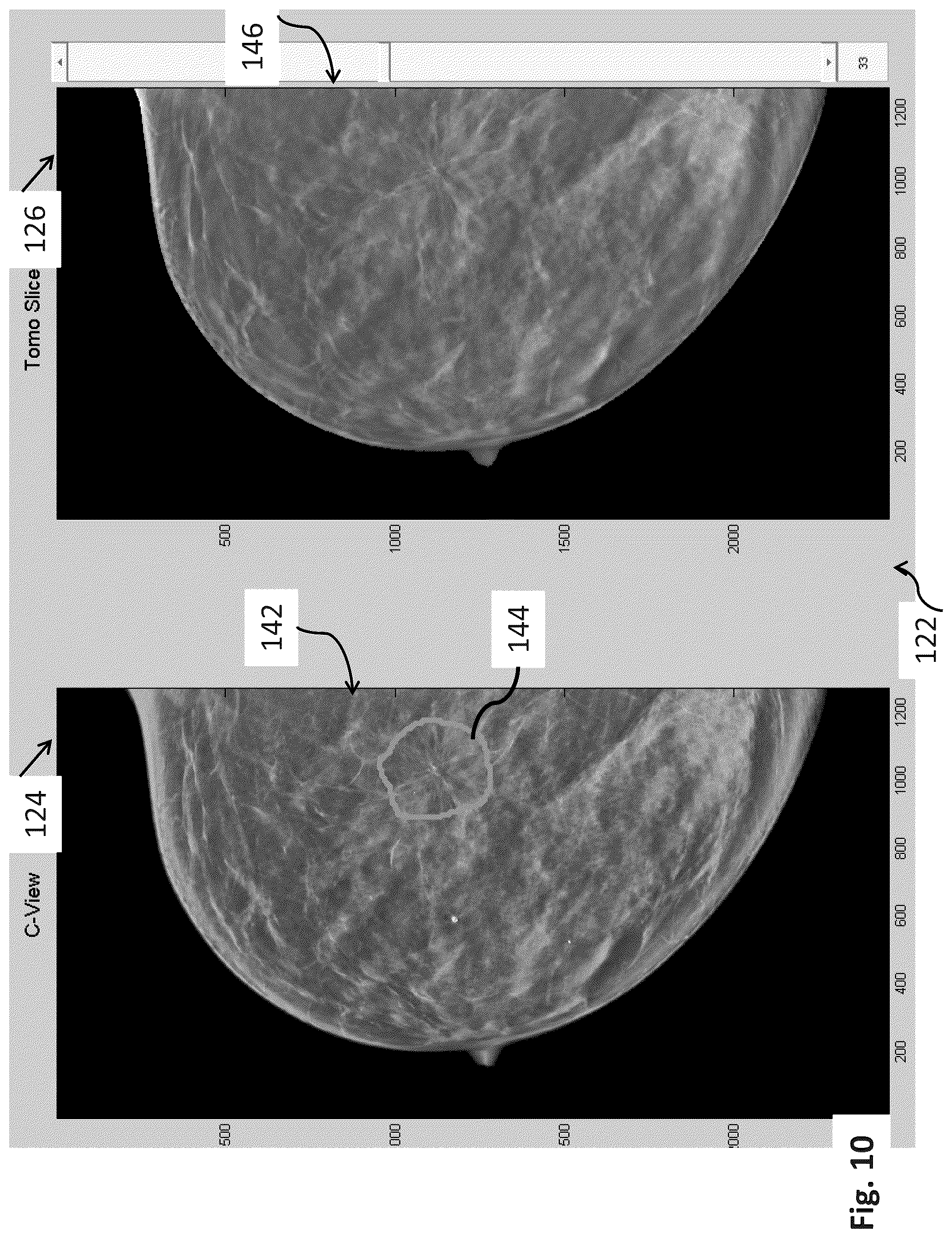Patent US12307604 Figure 10 – System and method for navigating a tomosynthesis stack using synthesized image data