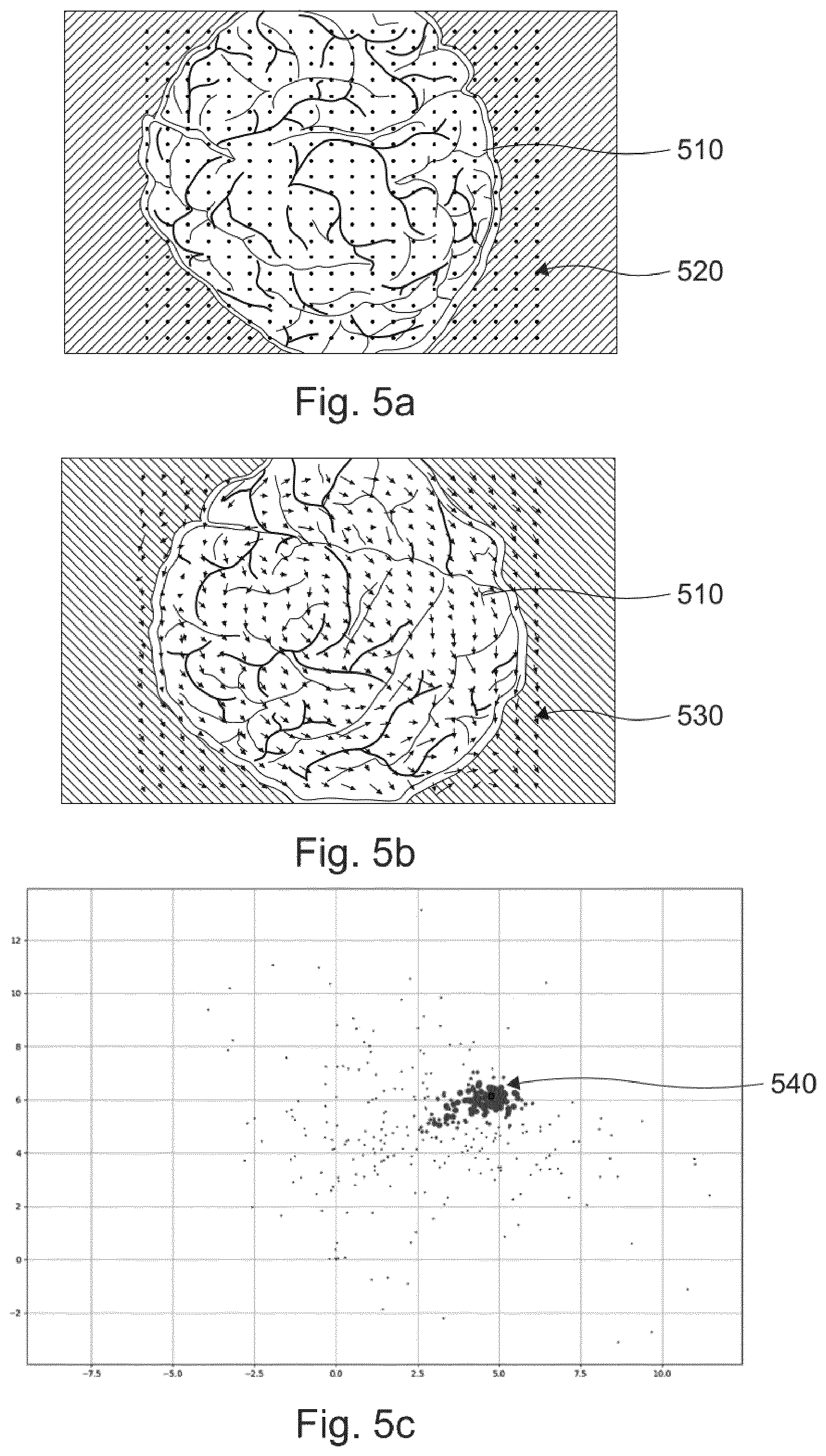 Patent US12307632 Figure 4 – Systems, methods, and computer programs for a microscope and microscope system