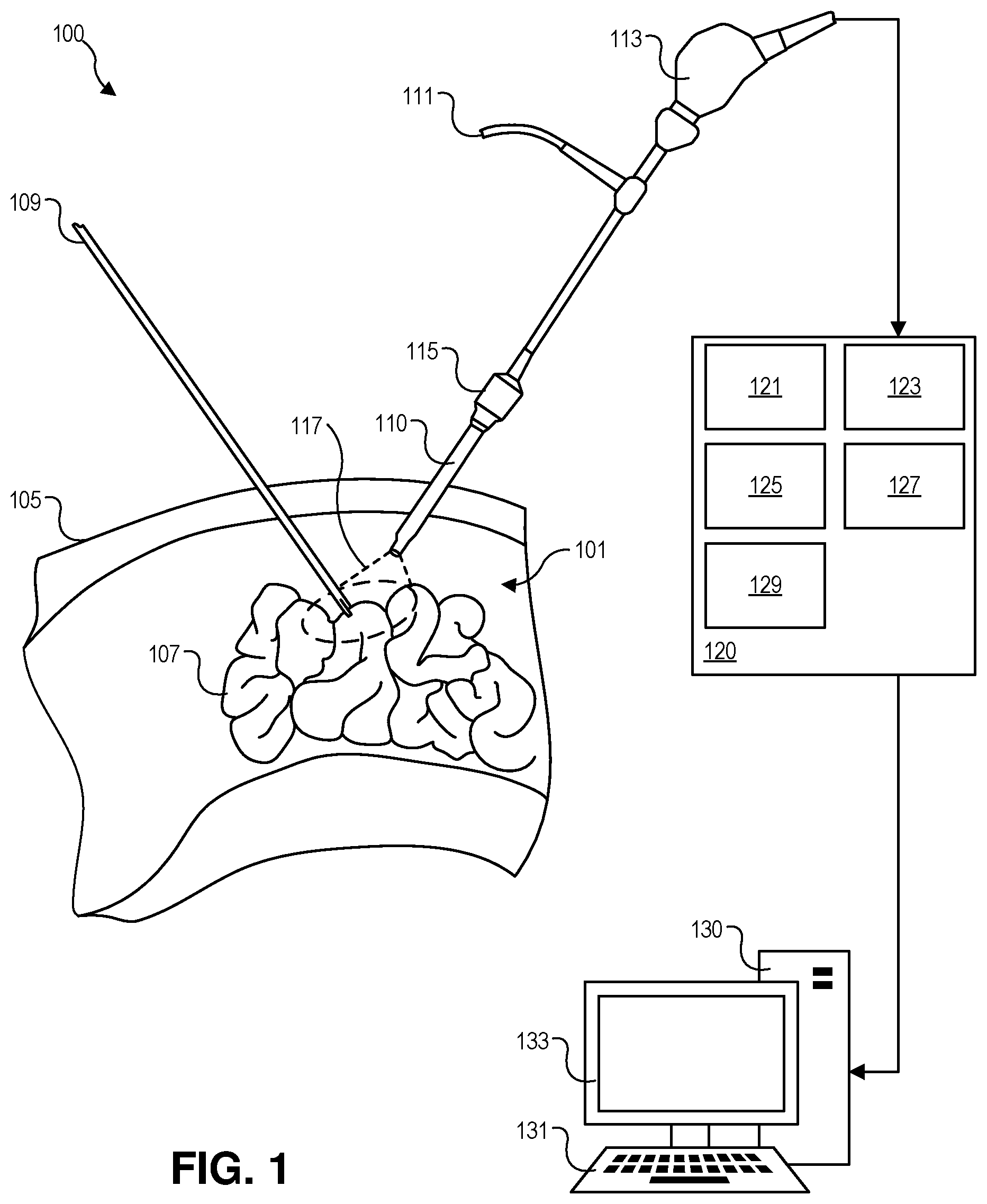 Patent US12307636 — Specular reflection reduction in endoscope visualization — Figure 1