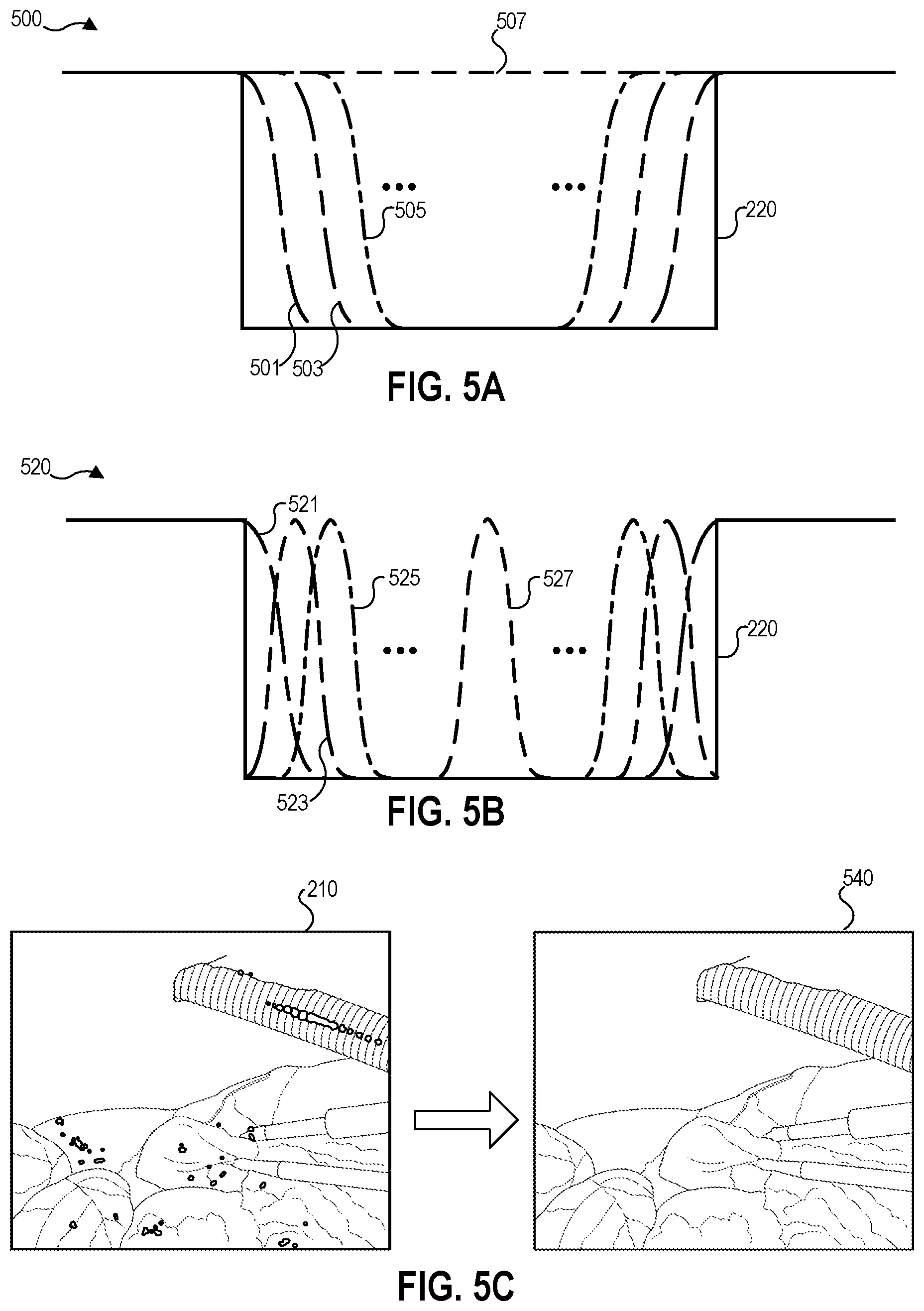 Patent US12307636 Figure 5 – Specular reflection reduction in endoscope visualization
