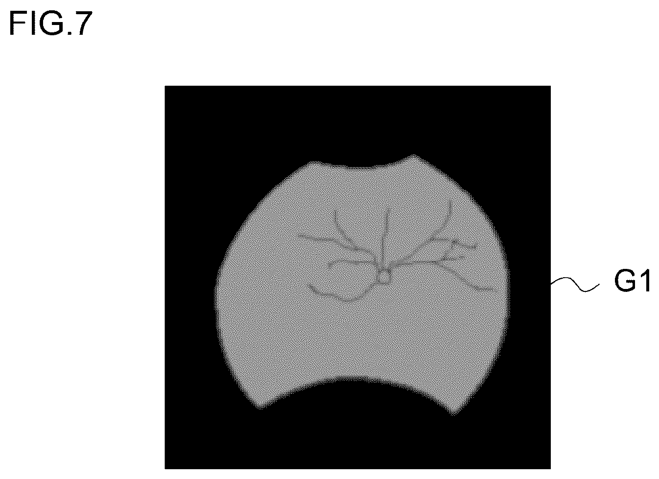 Patent US12307639 Figure 8 – Image processing method, image processing device, and program