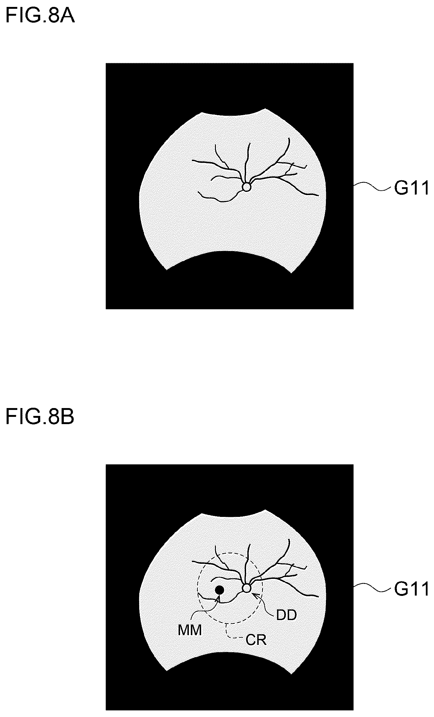 Patent US12307639 Figure 9 – Image processing method, image processing device, and program
