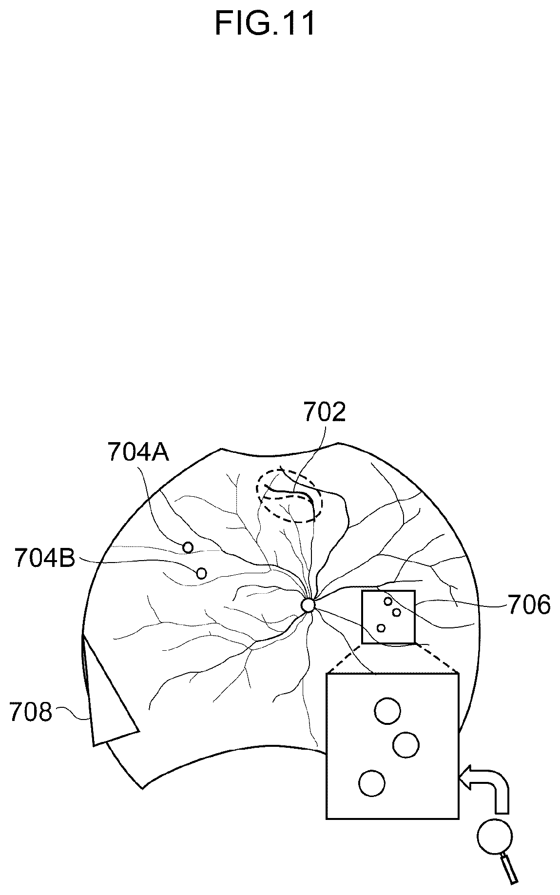 Patent US12307639 Figure 11 – Image processing method, image processing device, and program