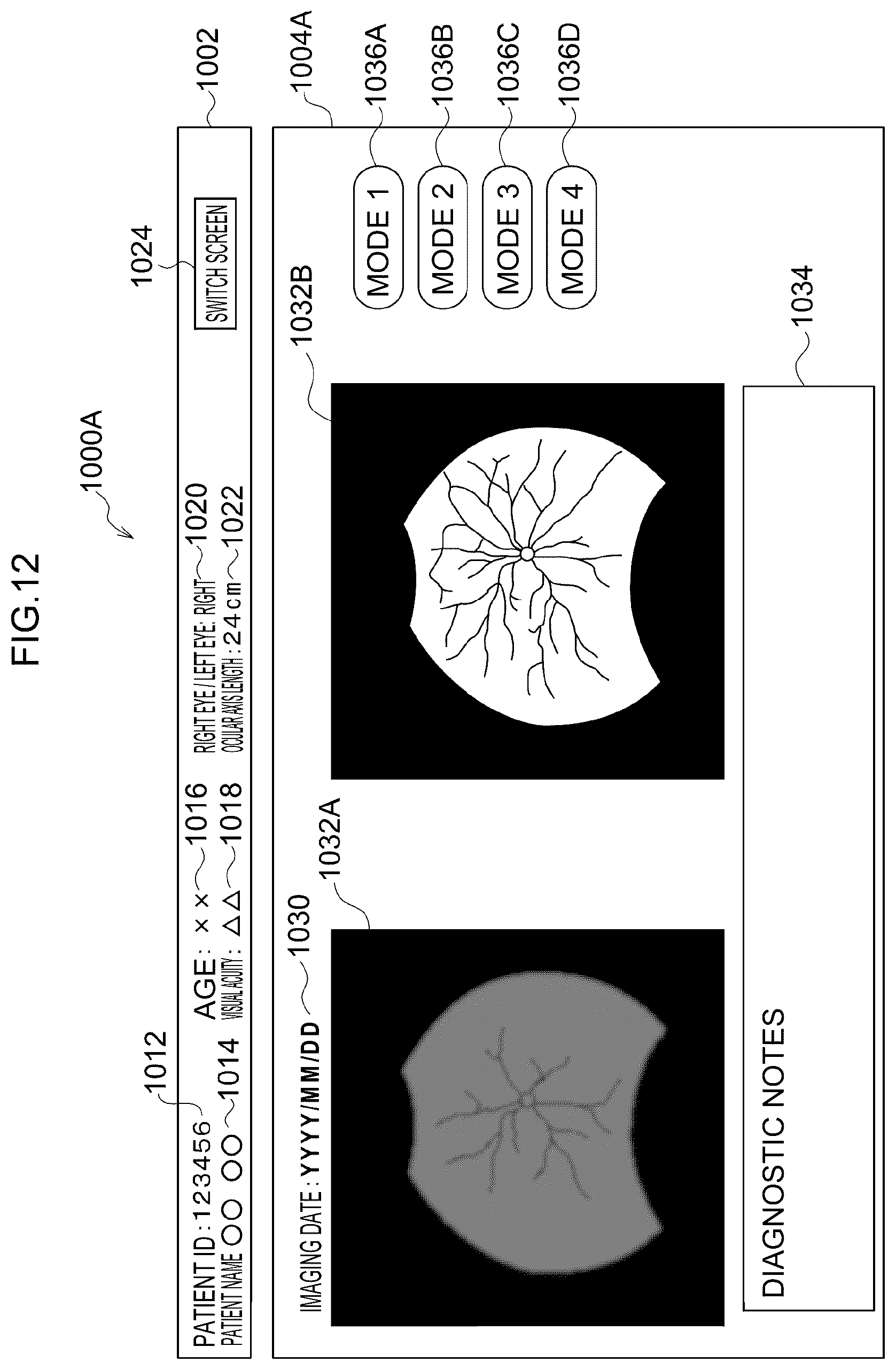 Patent US12307639 Figure 12 – Image processing method, image processing device, and program