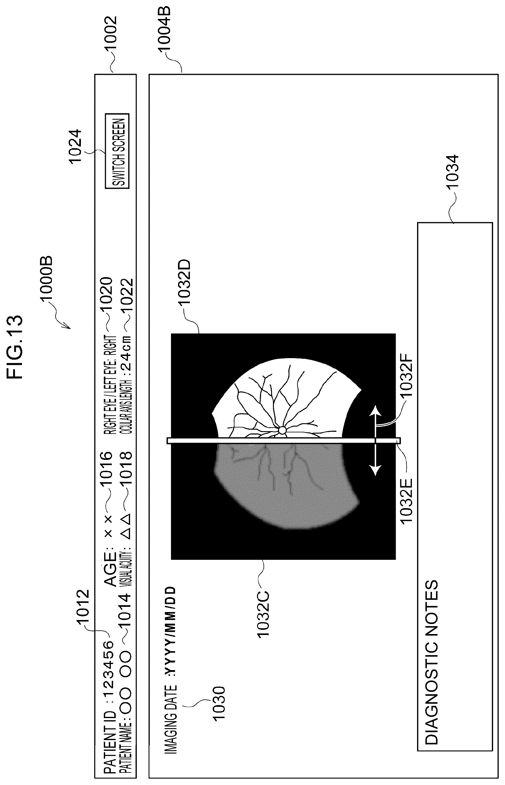 Patent US12307639 Figure 13 – Image processing method, image processing device, and program