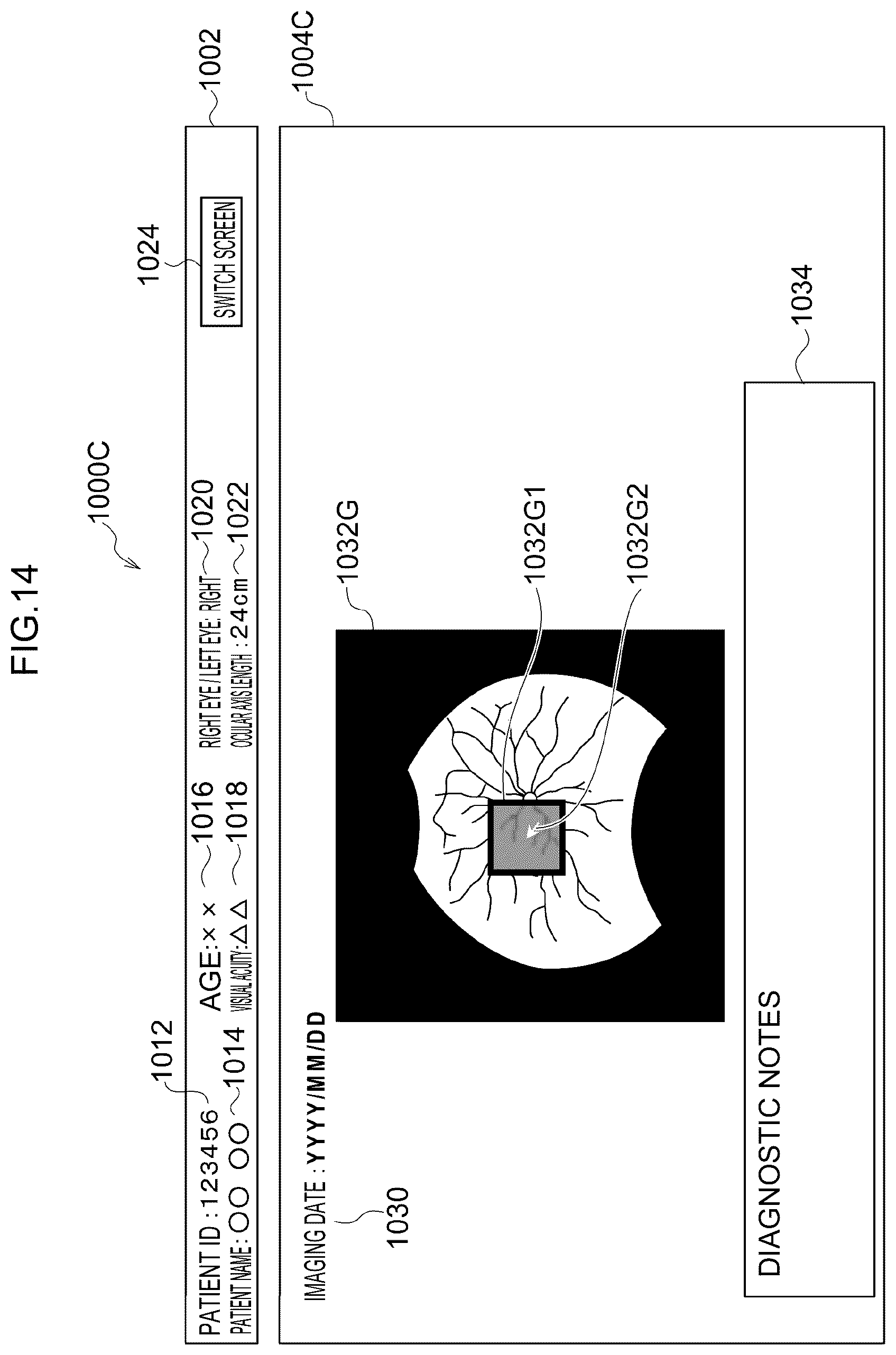 Patent US12307639 Figure 14 – Image processing method, image processing device, and program