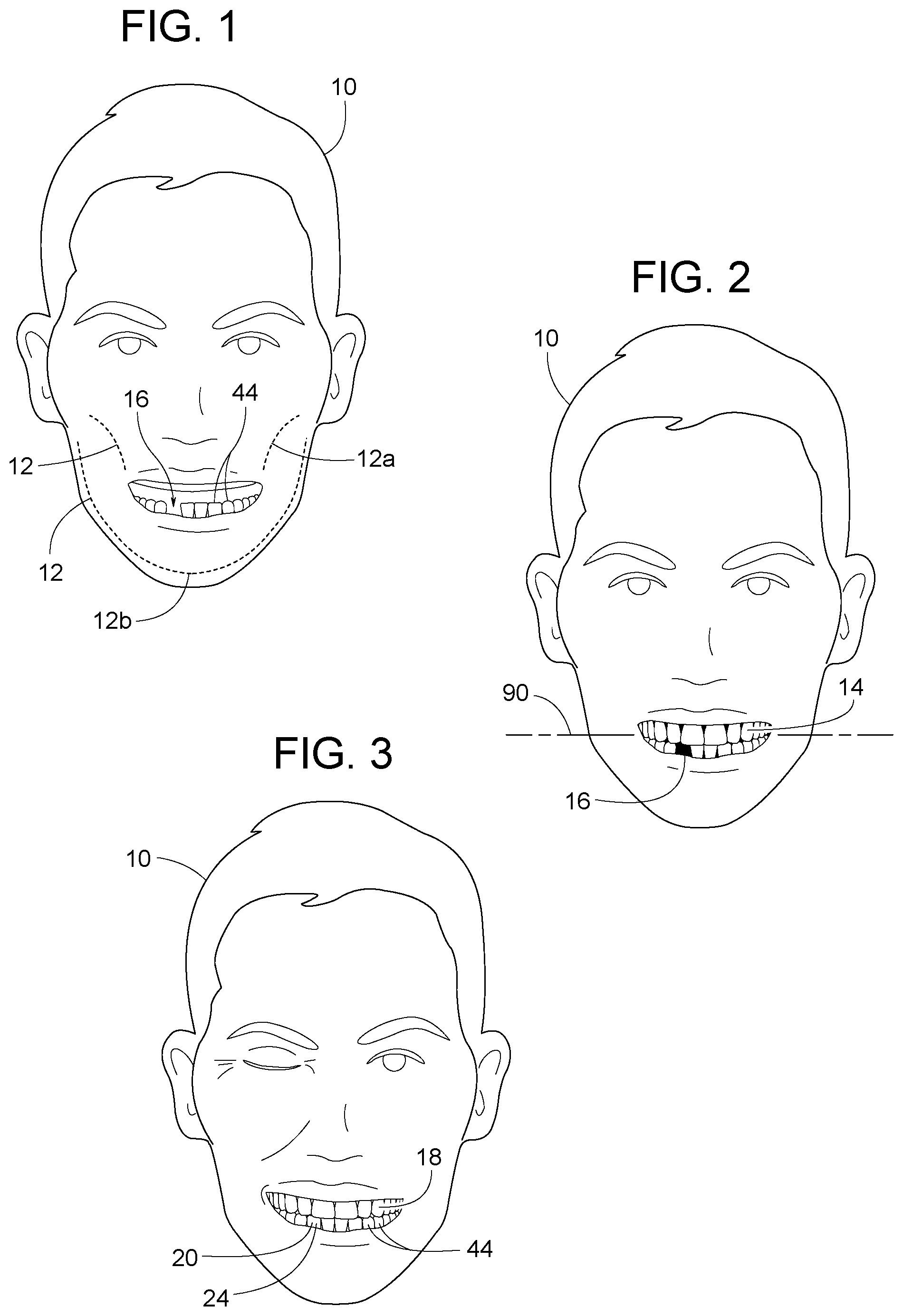 Patent US12307656 — Computer assisted dental methods for analyzing jaws — Figure 1
