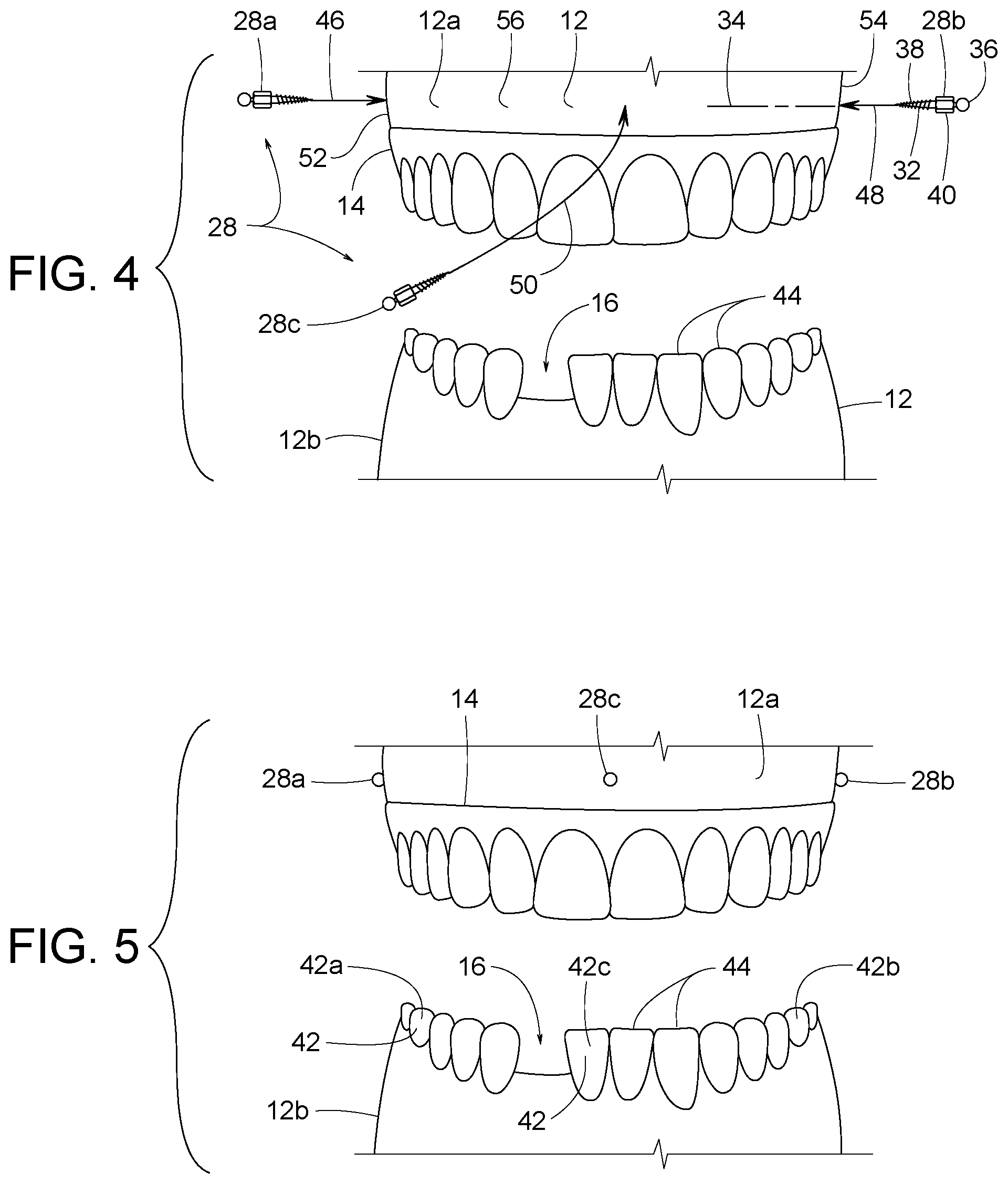Patent US12307656 Figure 2 – Computer assisted dental methods for analyzing jaws