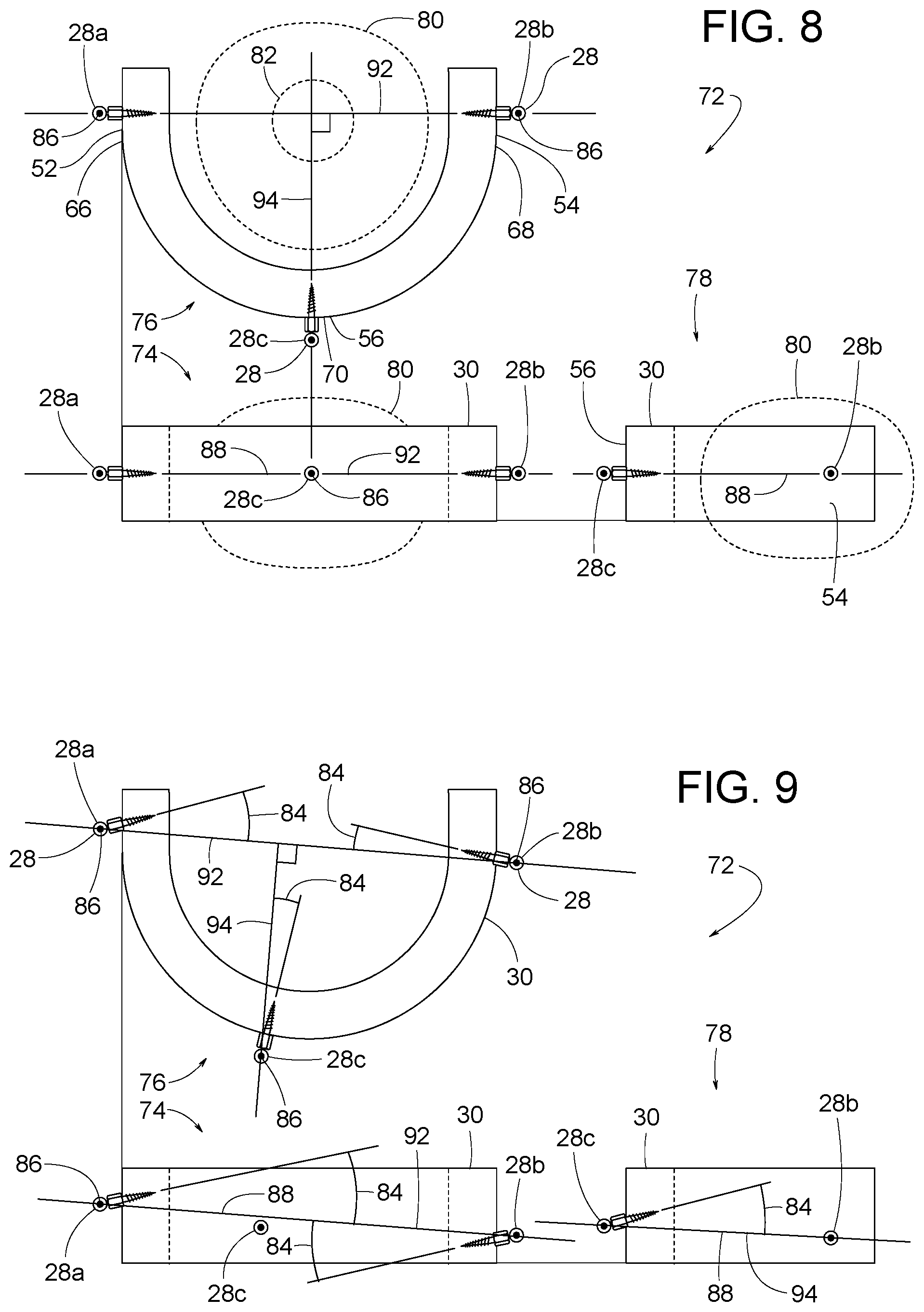 Patent US12307656 Figure 4 – Computer assisted dental methods for analyzing jaws