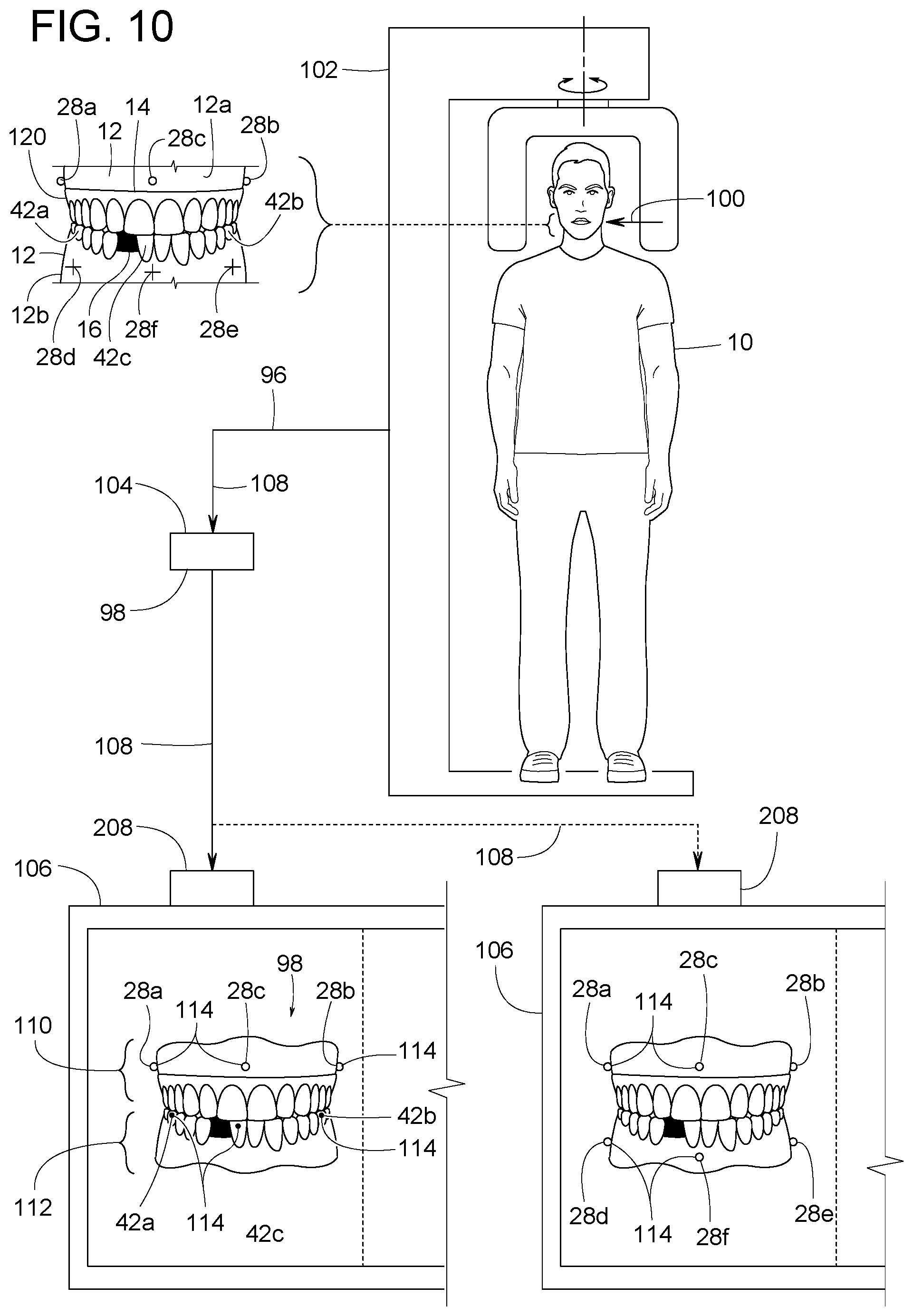 Patent US12307656 Figure 5 – Computer assisted dental methods for analyzing jaws