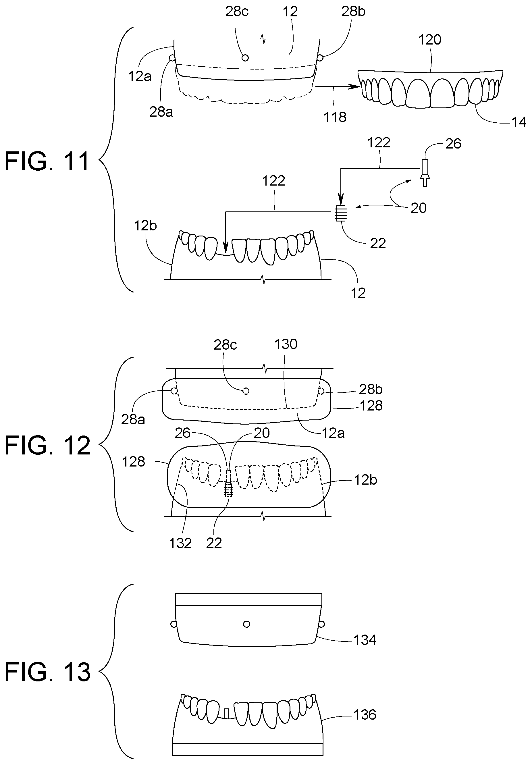 Patent US12307656 Figure 6 – Computer assisted dental methods for analyzing jaws