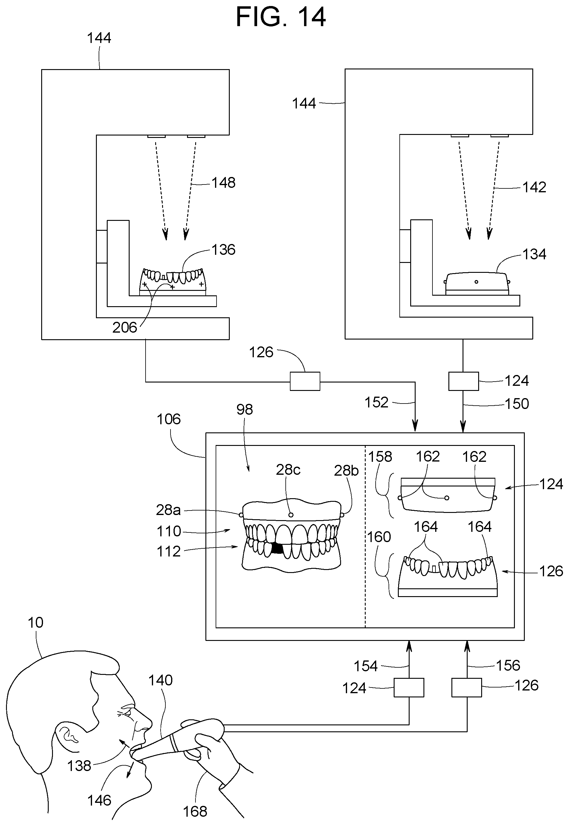 Patent US12307656 Figure 7 – Computer assisted dental methods for analyzing jaws