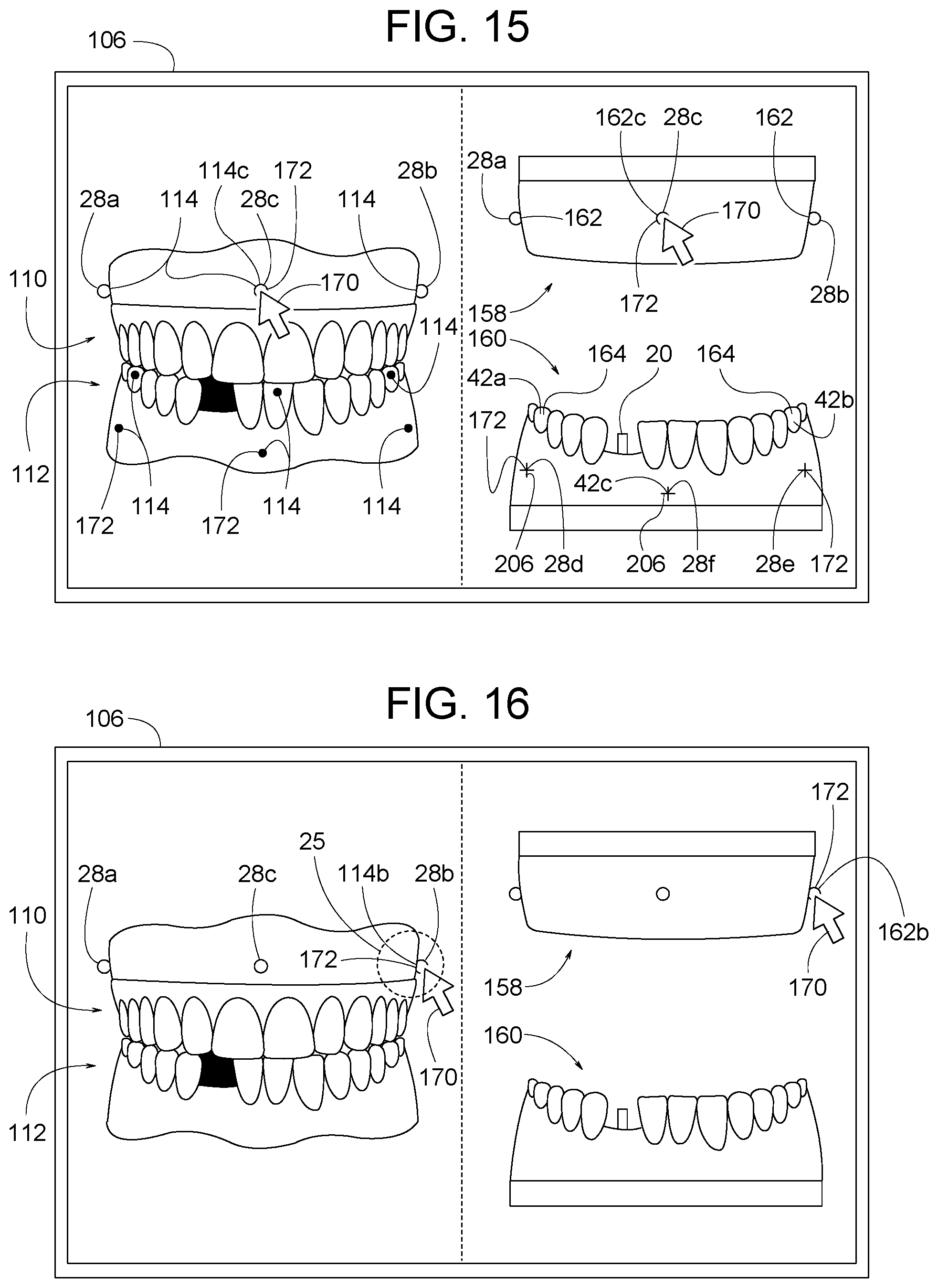 Patent US12307656 Figure 8 – Computer assisted dental methods for analyzing jaws